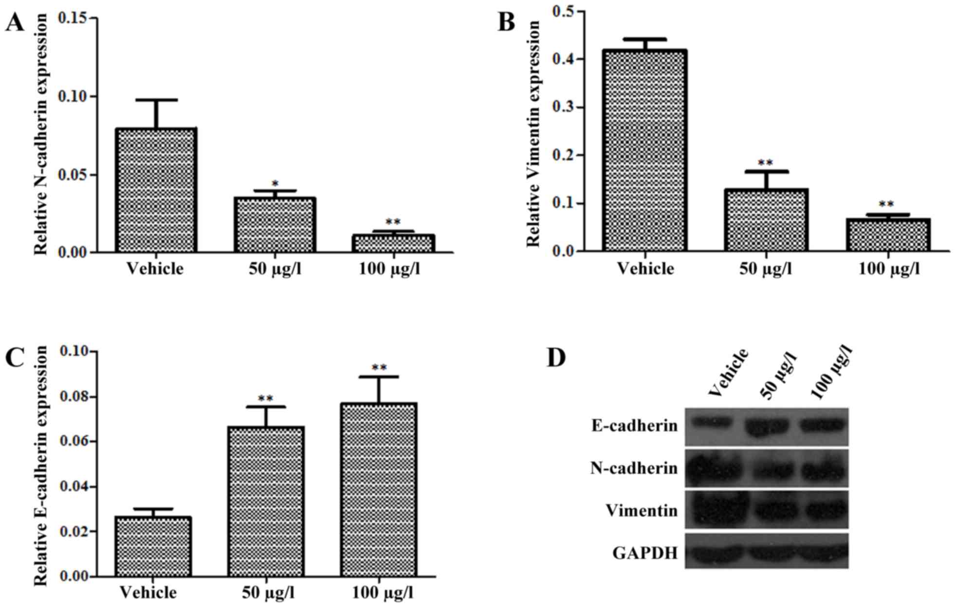 Oldhamianoside Ii Inhibits Prostate Cancer Progression Via Regulation Of Emt And The Wnt B Catenin Signaling Pathway