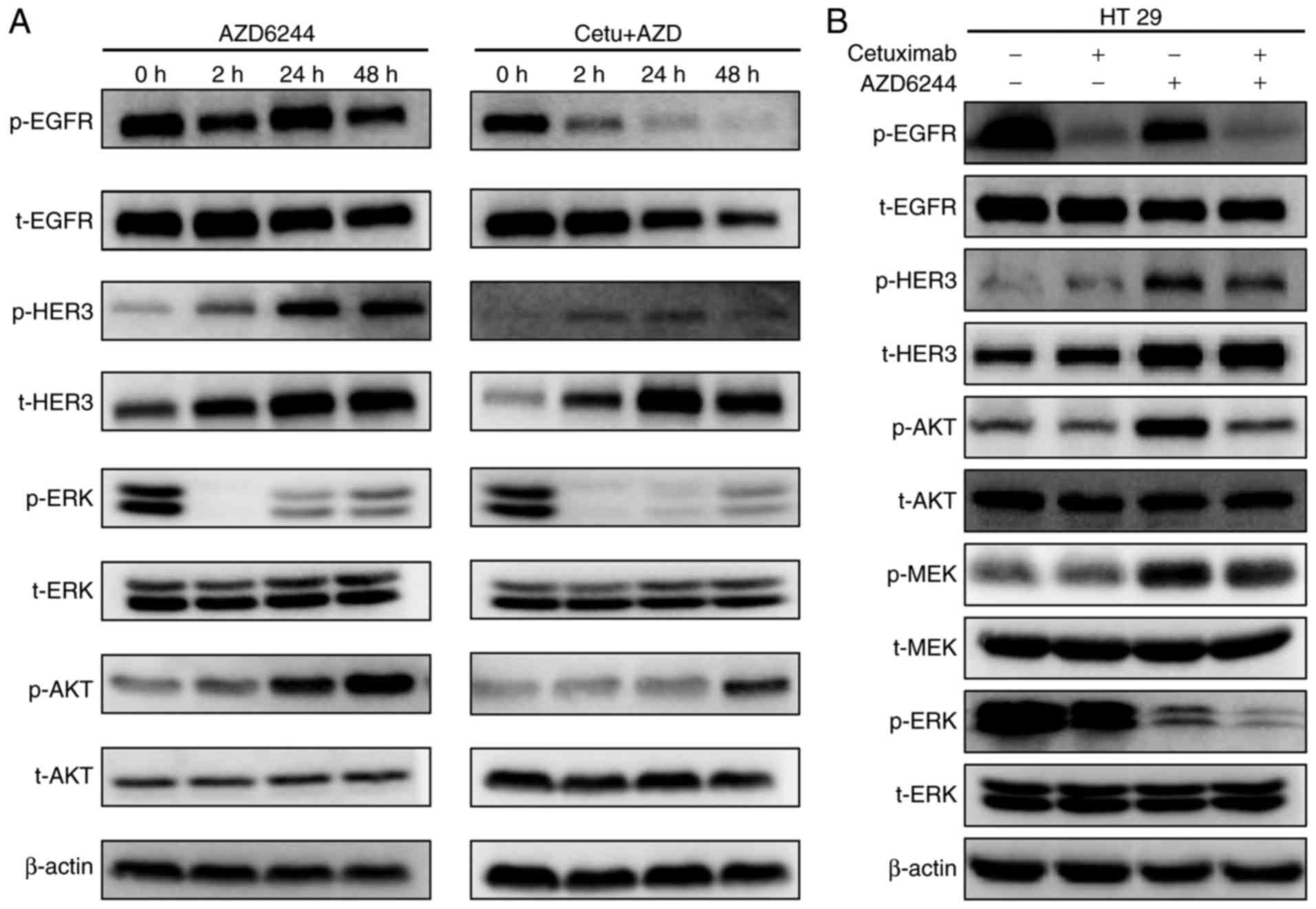 Cetuximab improves AZD6244 antitumor activity in 