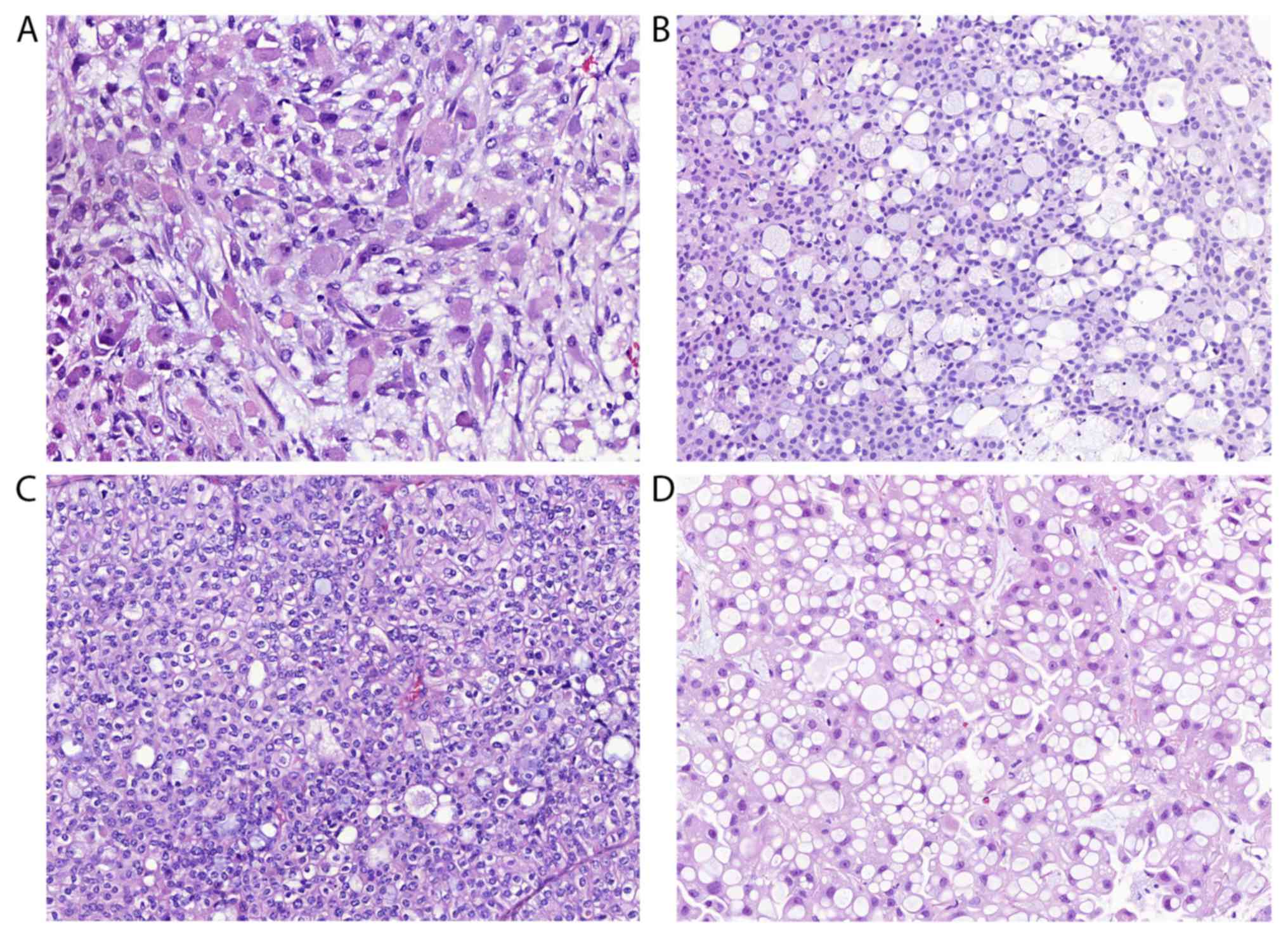 What Is Transitional Cell Carcinoma In Dogs