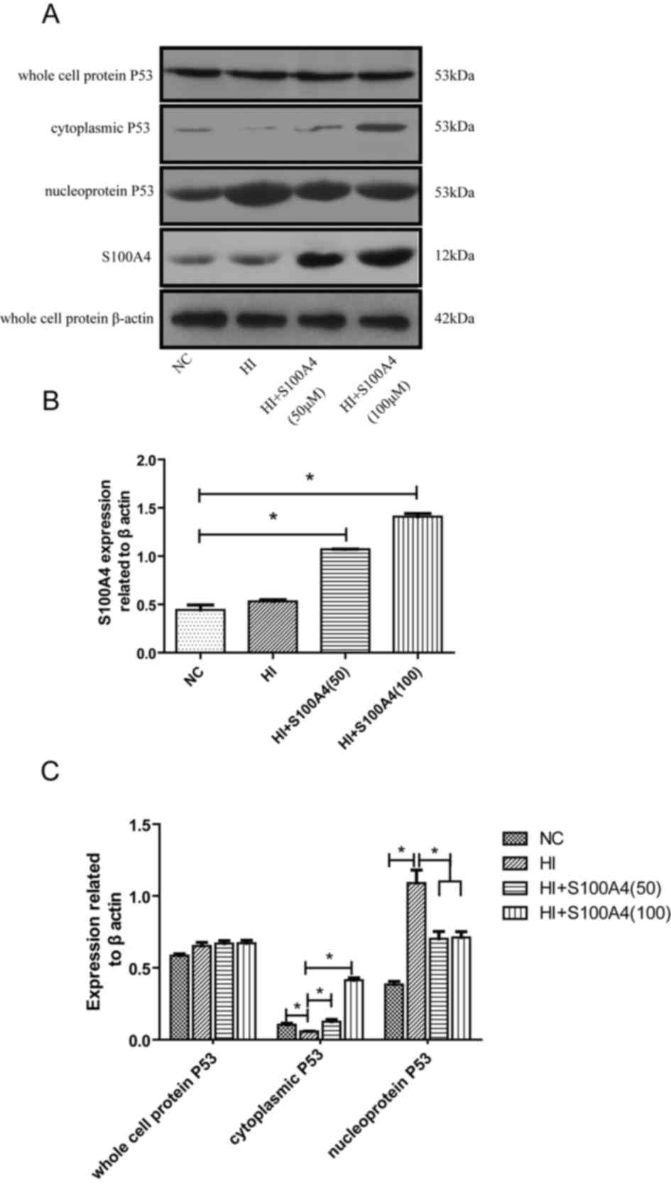 Protective Effect And Mechanism Of Rat Recombinant S100 Calcium Binding Protein On Oxidative Stress Injury Of Rat Vascular Endothelial Cells