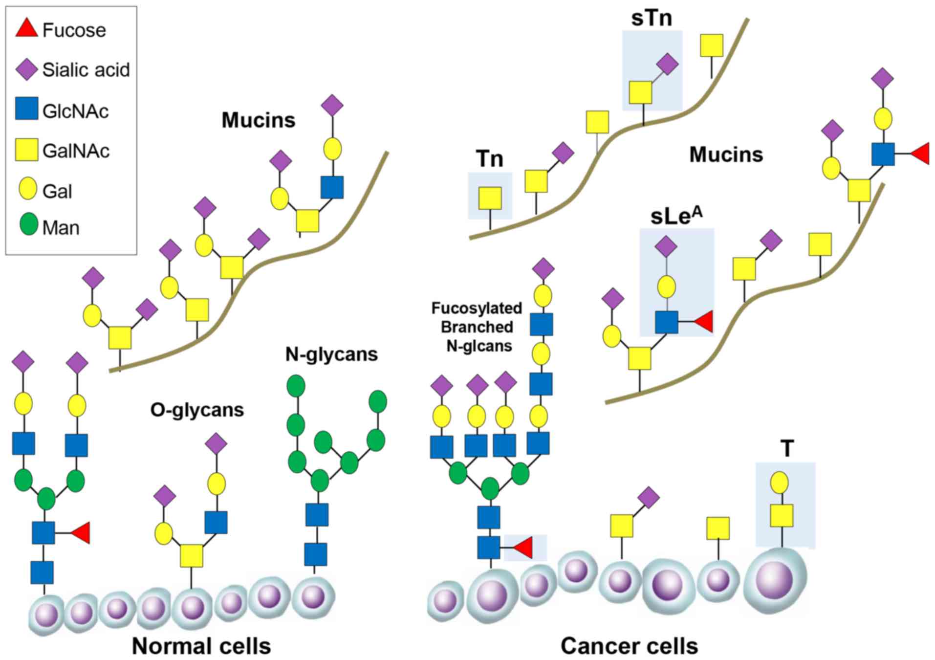 The Glycosylation Landscape Of Pancreatic Cancer Review