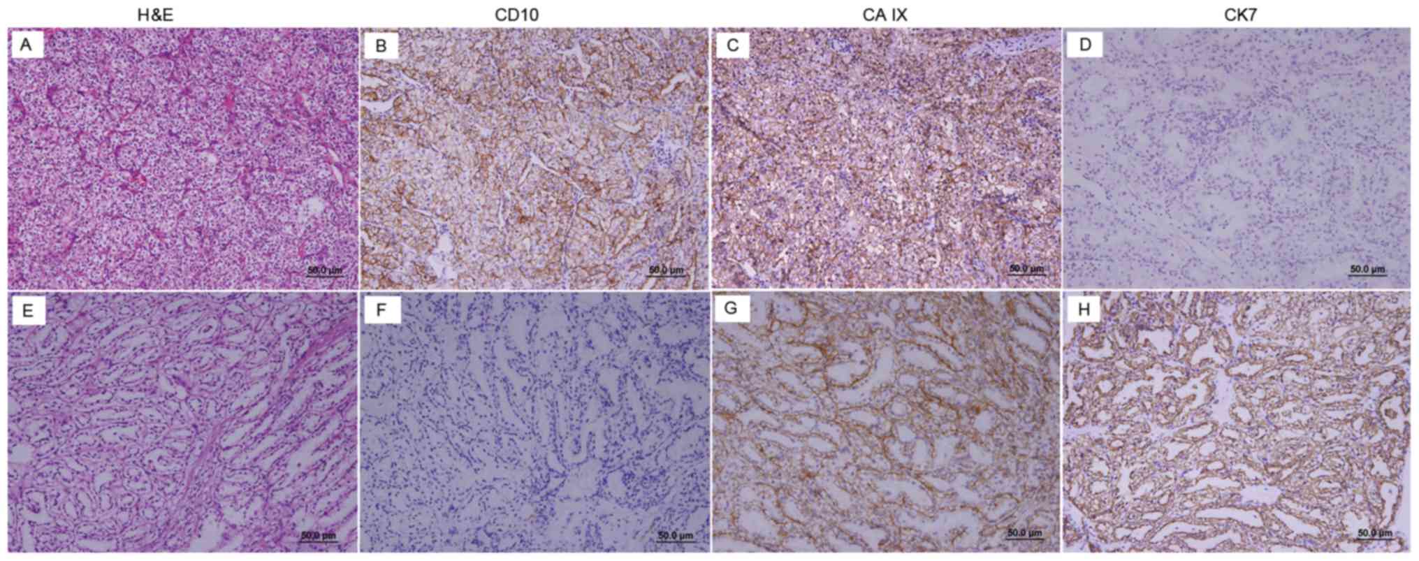 is transitional cell carcinoma curable in dogs