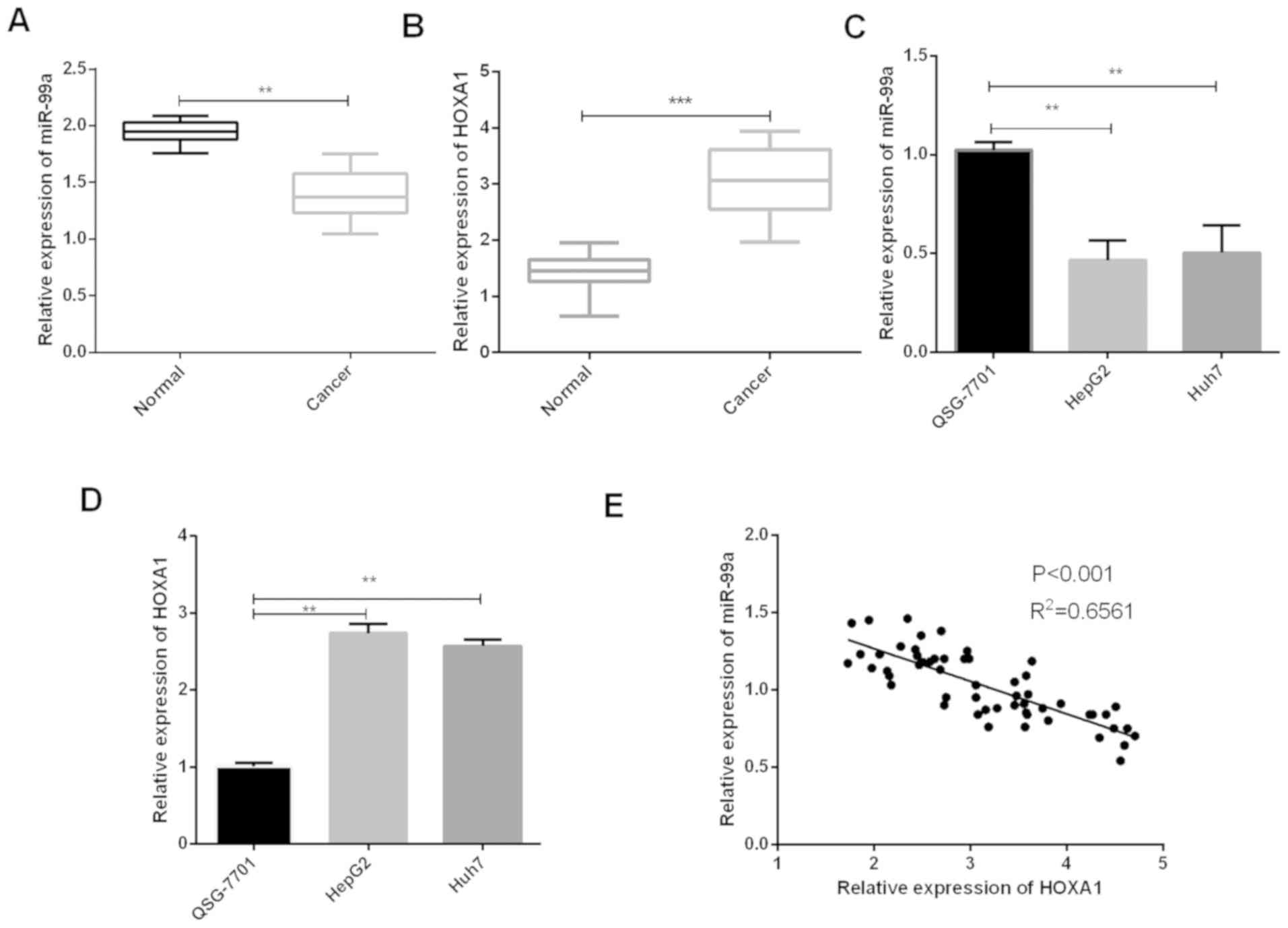 Mirna 99a Inhibits Cell Invasion And Migration In Liver Cancer By Directly Targeting Hoxa1