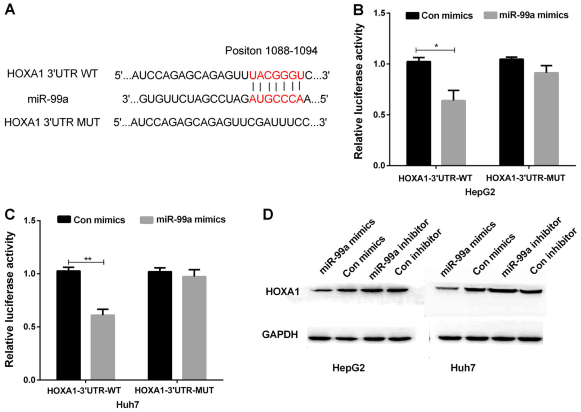 Mirna 99a Inhibits Cell Invasion And Migration In Liver Cancer By Directly Targeting Hoxa1