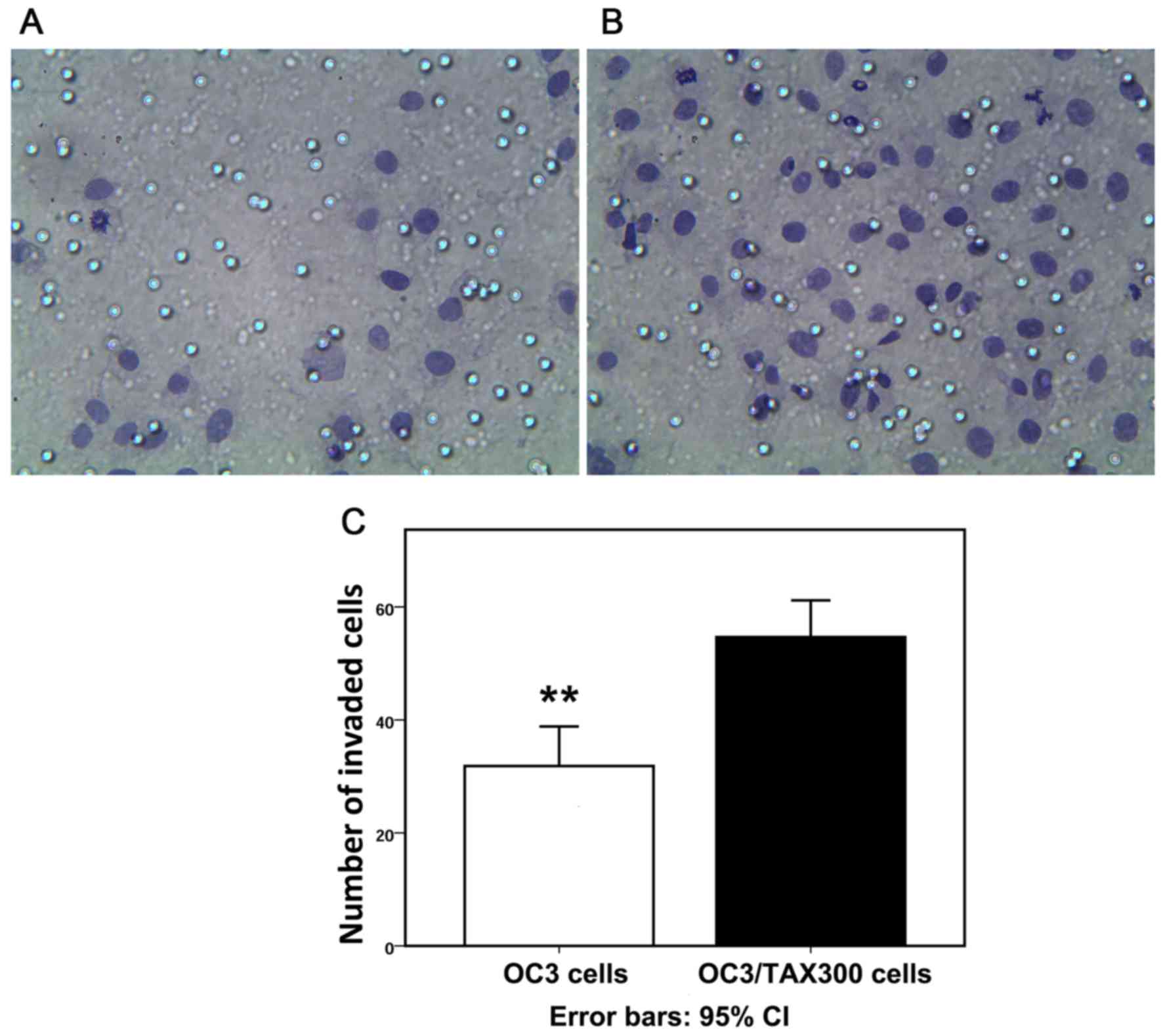 Human epithelial ovarian cancer cells expressing CD105, CD44 and 