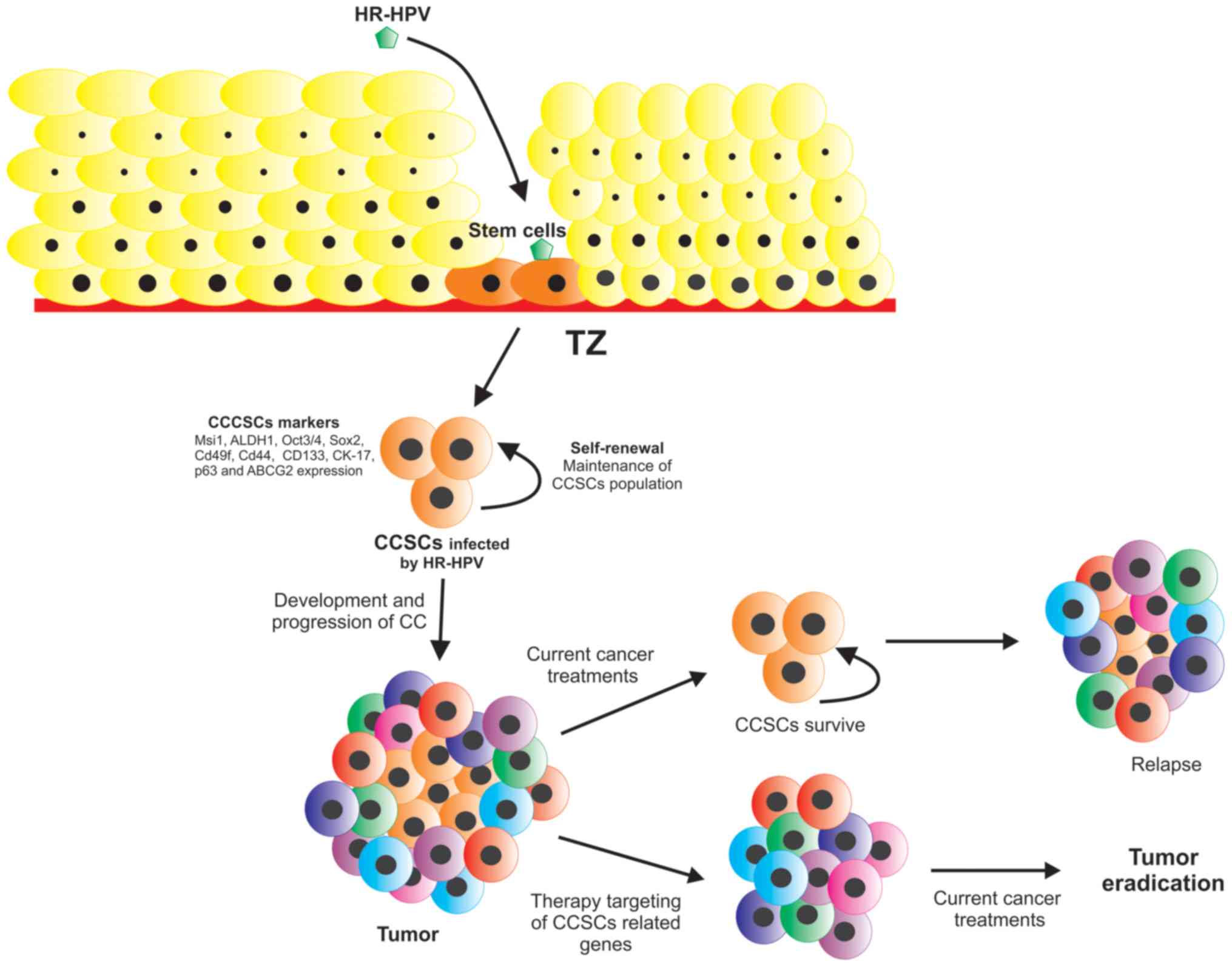 papilloma cancer cells)