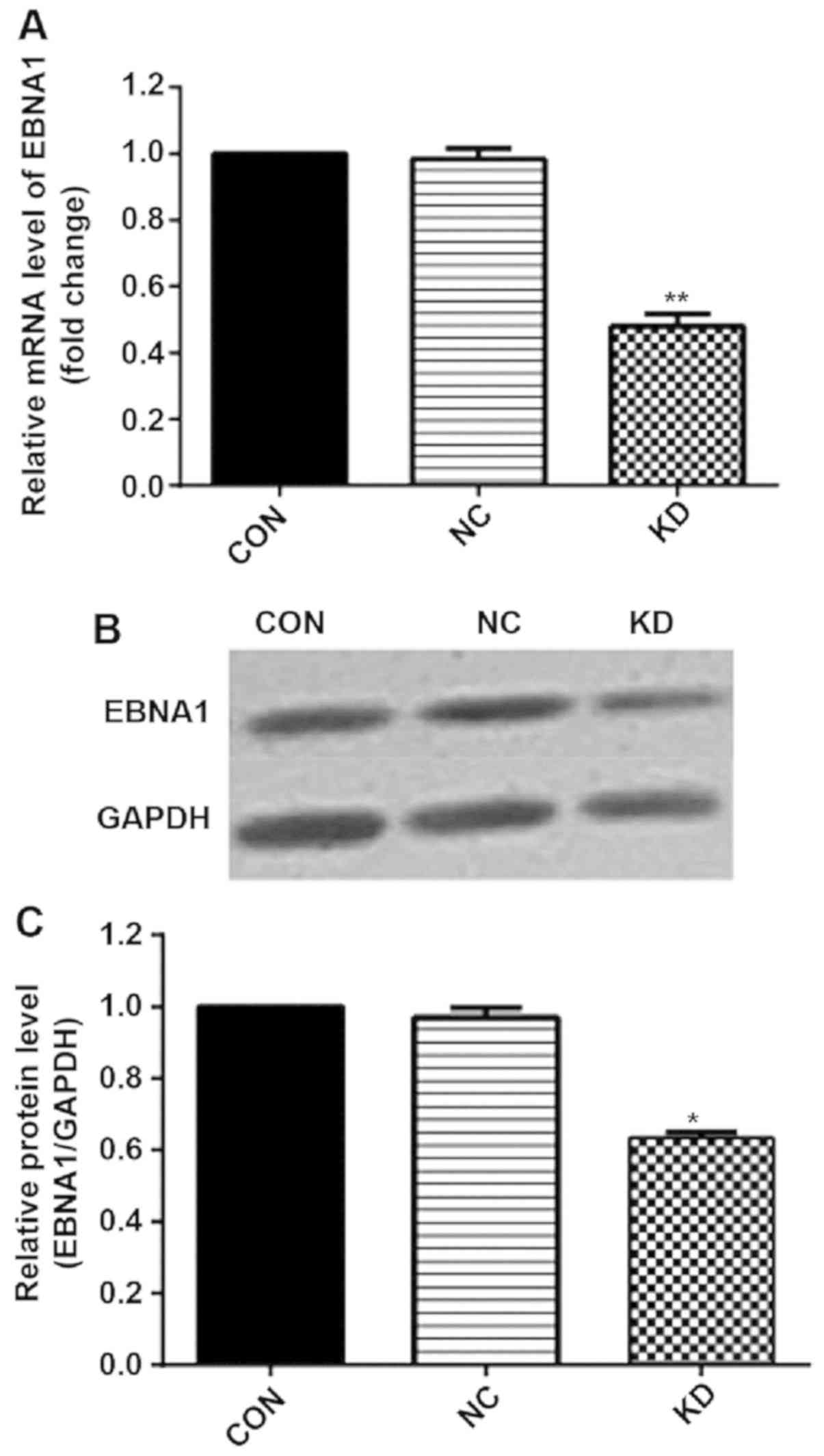 Lentivirus Mediated Rna Interference Targeting Ebna1 Gene Inhibits The Growth Of Gt 38 Cells In Vitro And In Vivo