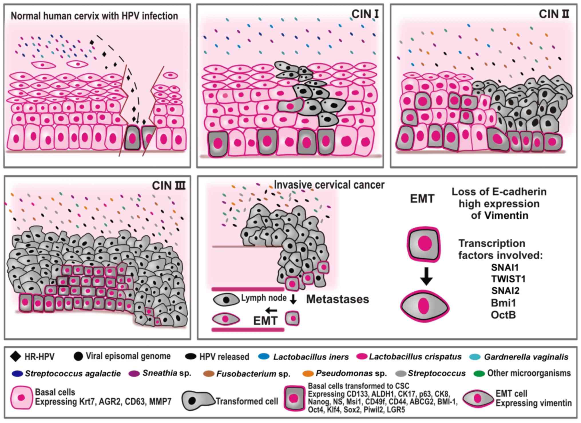 hpv and cancer review)