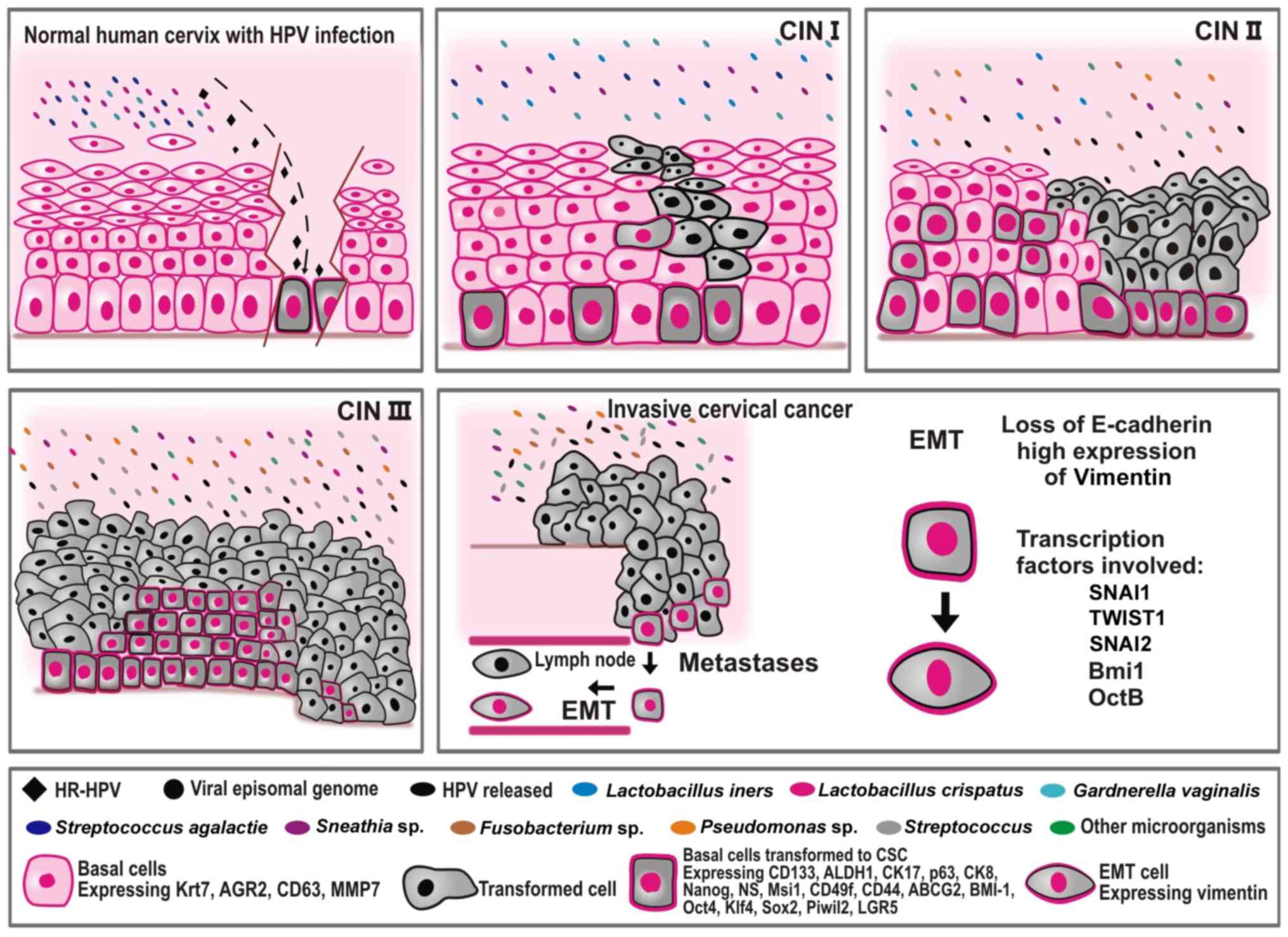 hpv treatment ncbi)