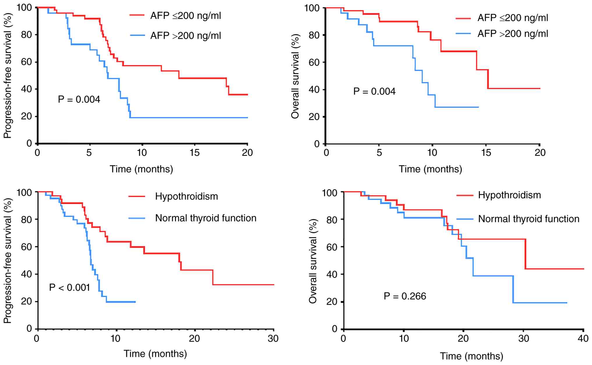 Comparison of PFS and OS between two
groups of male patients with hepatocellular carcinoma. OS, overall
survival; PFS, progression-free survival; AFP, α-fetoprotein.
