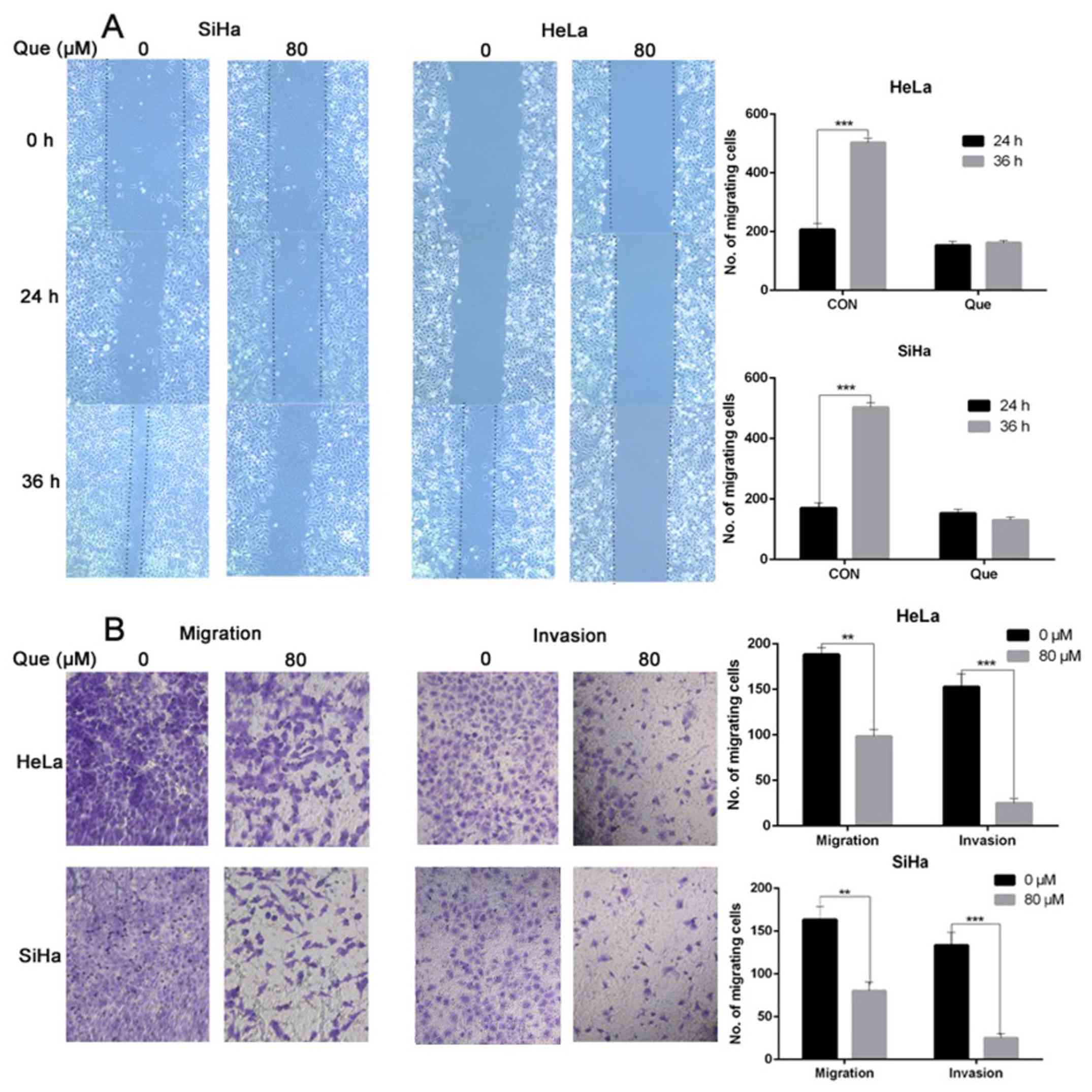 Que inhibits the migration and
invasion of the cervical cancer cell lines. (A) The cells were
treated with 0 or 80 µM Que for 0, 24 and 36 h, then the degree of
wound healing was measured. (B) In total, ~10,000 SiHa and HeLa
cells were seeded in the Transwell chamber in 200 µl FBS-free
medium with the indicated concentration of Que for 48 h. Matrigel
was added onto the microporous membrane in advance to simulate the
environment of the extracellular matrix was only used for the
invasion assay, and then the cells that penetrated the membrane
were stained with crystal violet for subsequent examination. n=3.
**P<0.01, ***P<0.001. Que, quercetin.