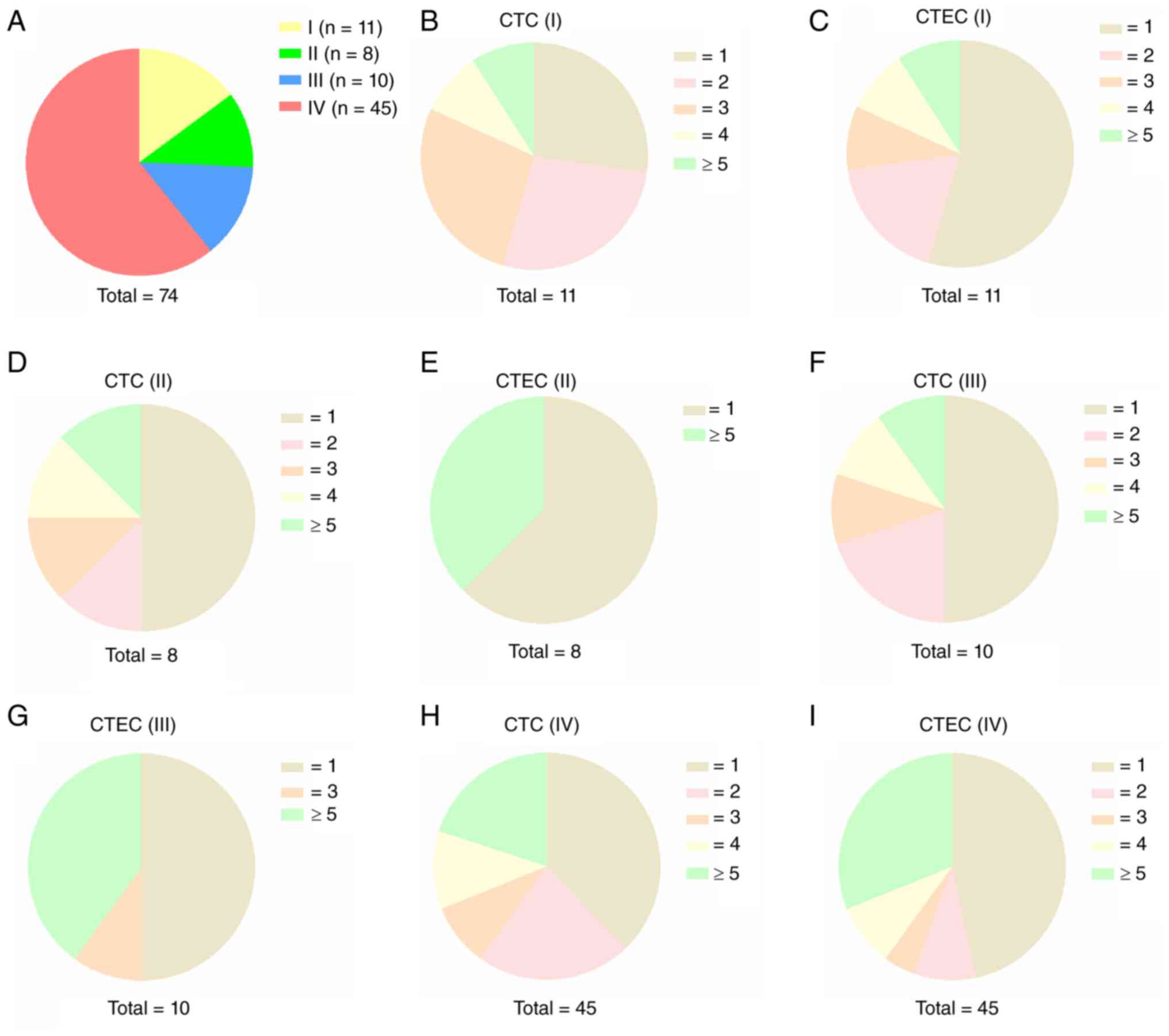 Stage-stratified distribution of CTC
and CTEC in 74 patients with lung cancer. (A) Cross-stage overview.
(B) Distribution of CTCs in Stage I patients (total n=11). (C)
Distribution of CTECs in Stage I patients (total n=11). (D)
Distribution of CTCs in Stage II patients (total n=8). (E)
Distribution of CTECs in Stage II patients (Total=8). (F)
Distribution of CTCs in Stage III patients (Total=10). (G)
Distribution of CTECs in Stage III patients (total n=10). (H)
Distribution of CTCs in Stage IV patients (total n=45) (I)
Distribution of CTECs in Stage IV patients (total n=45). Values: 1,
2, 3, 4, ≥5 cells/7.5 ml peripheral blood. CTC, circulating tumor
cells; CTEC, circulating tumor-derived endothelial cells.