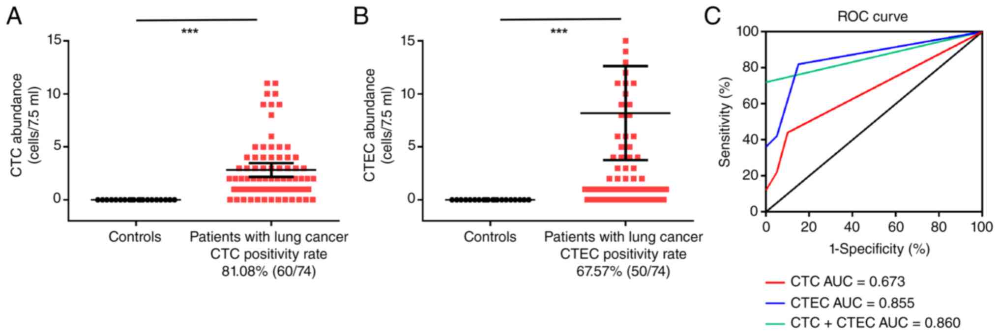 Comparison of (A) CTC and (B) CTEC
abundance between controls and patients with lung cancer. (C) ROC
curves of CTC, CTEC and their sum (CTC+CTEC) for distinguishing
patients with lung cancer from healthy controls. The DeLong test
showed no significant difference between the AUC of CTEC alone and
the combination (CTC+CTEC) (P=0.724). ***P<0.0001. CTC,
circulating tumor cells; CTEC, circulating tumor-derived
endothelial cells; ROC, receiver operating characteristic; AUC,
area under the ROC curve.