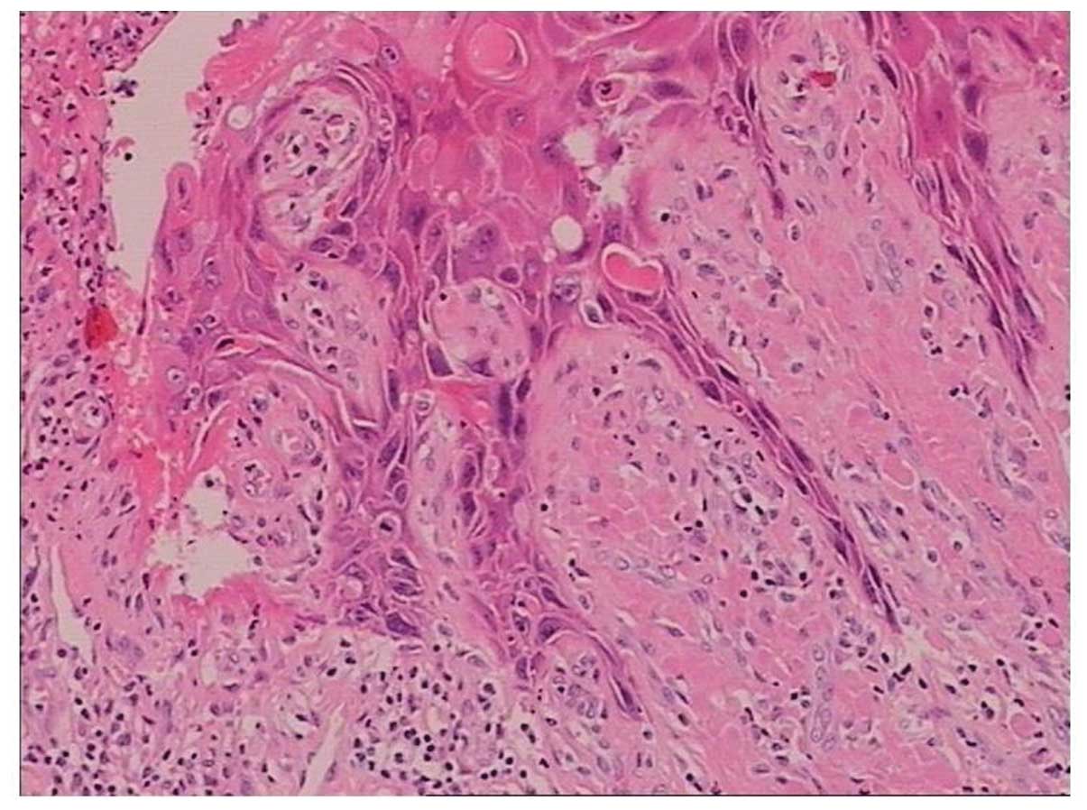 condyloma acuminata ncbi a helmintok autotróf vagy heterotrófak