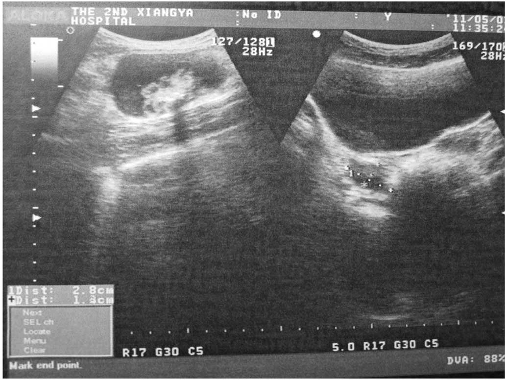 Mature Pregnant Tube