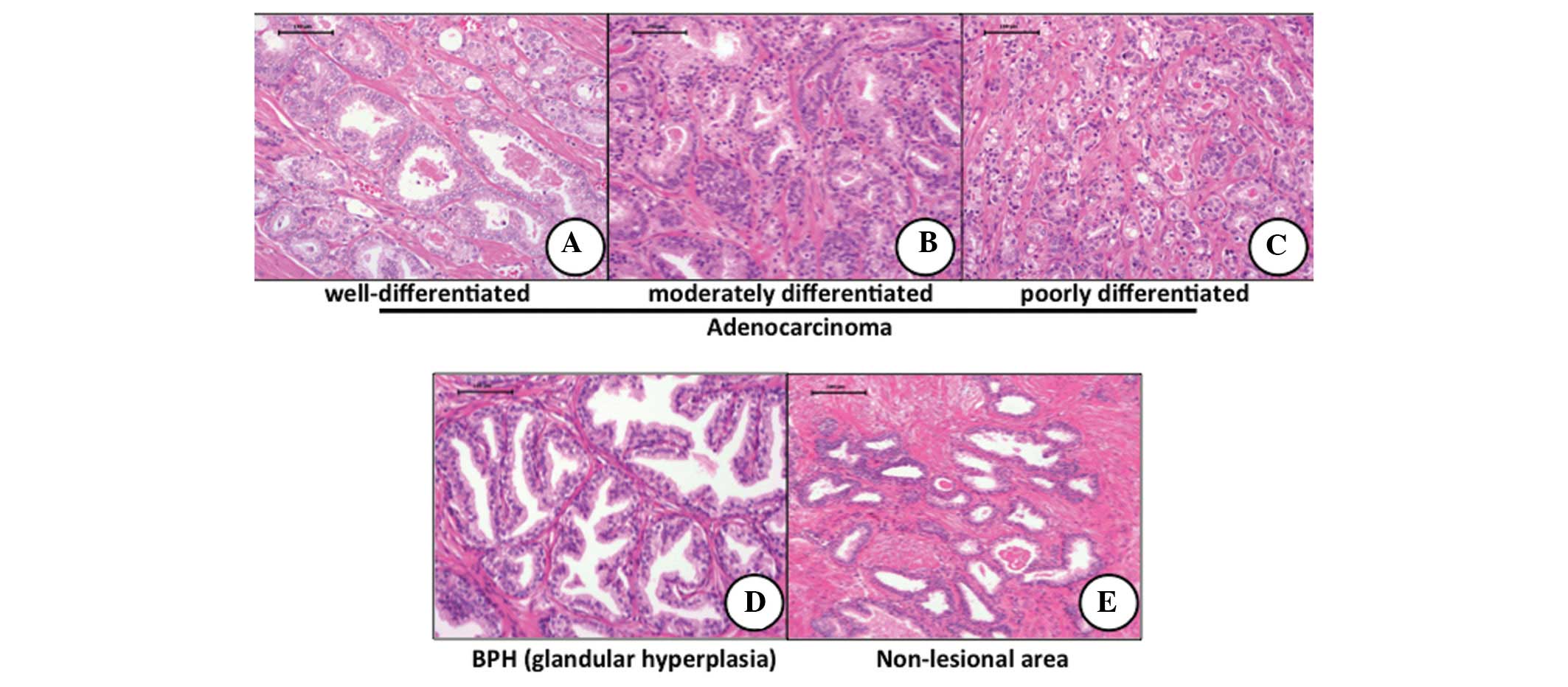 Zinnat prostatitis urethritis