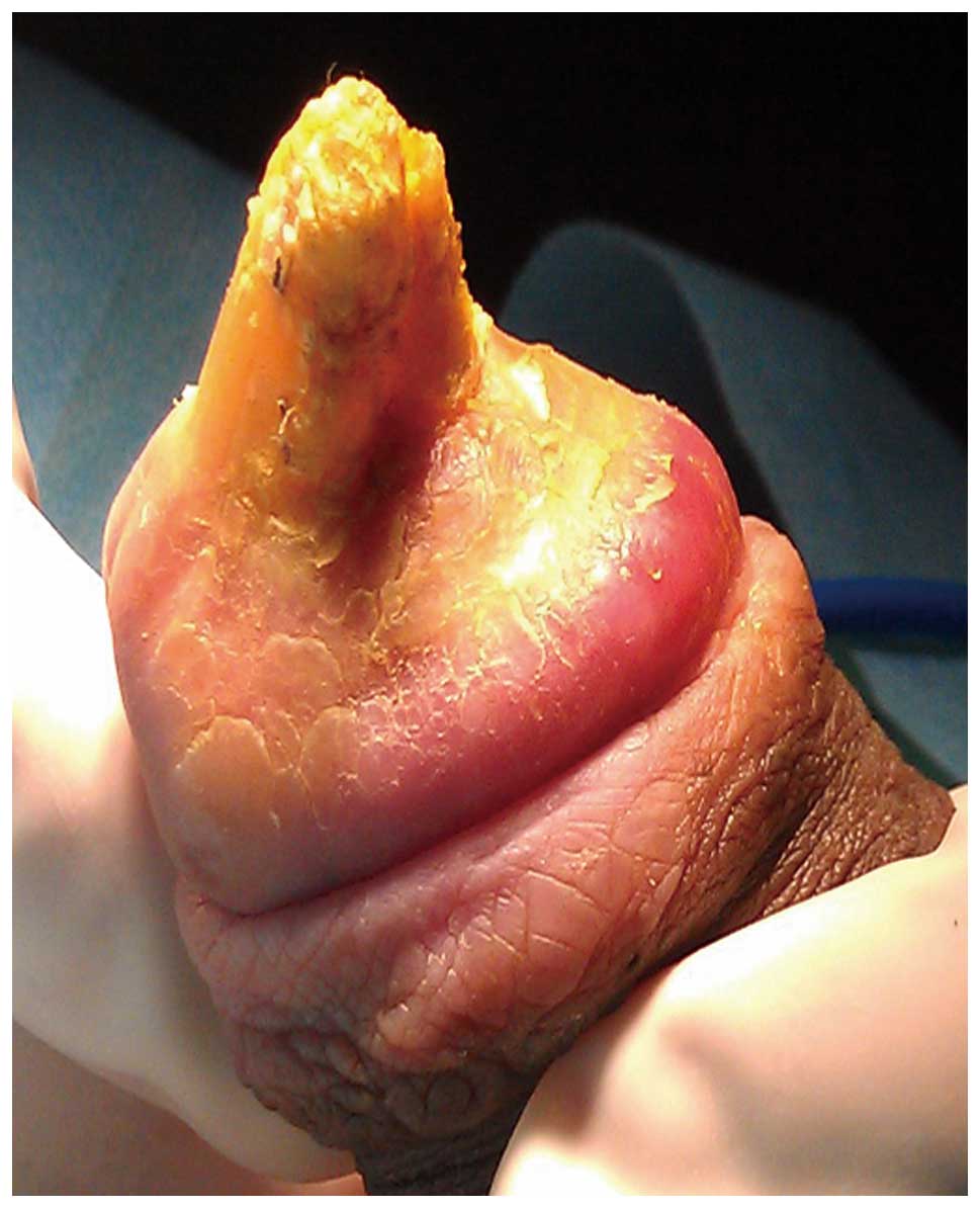 Yellow Spots On Penis 58