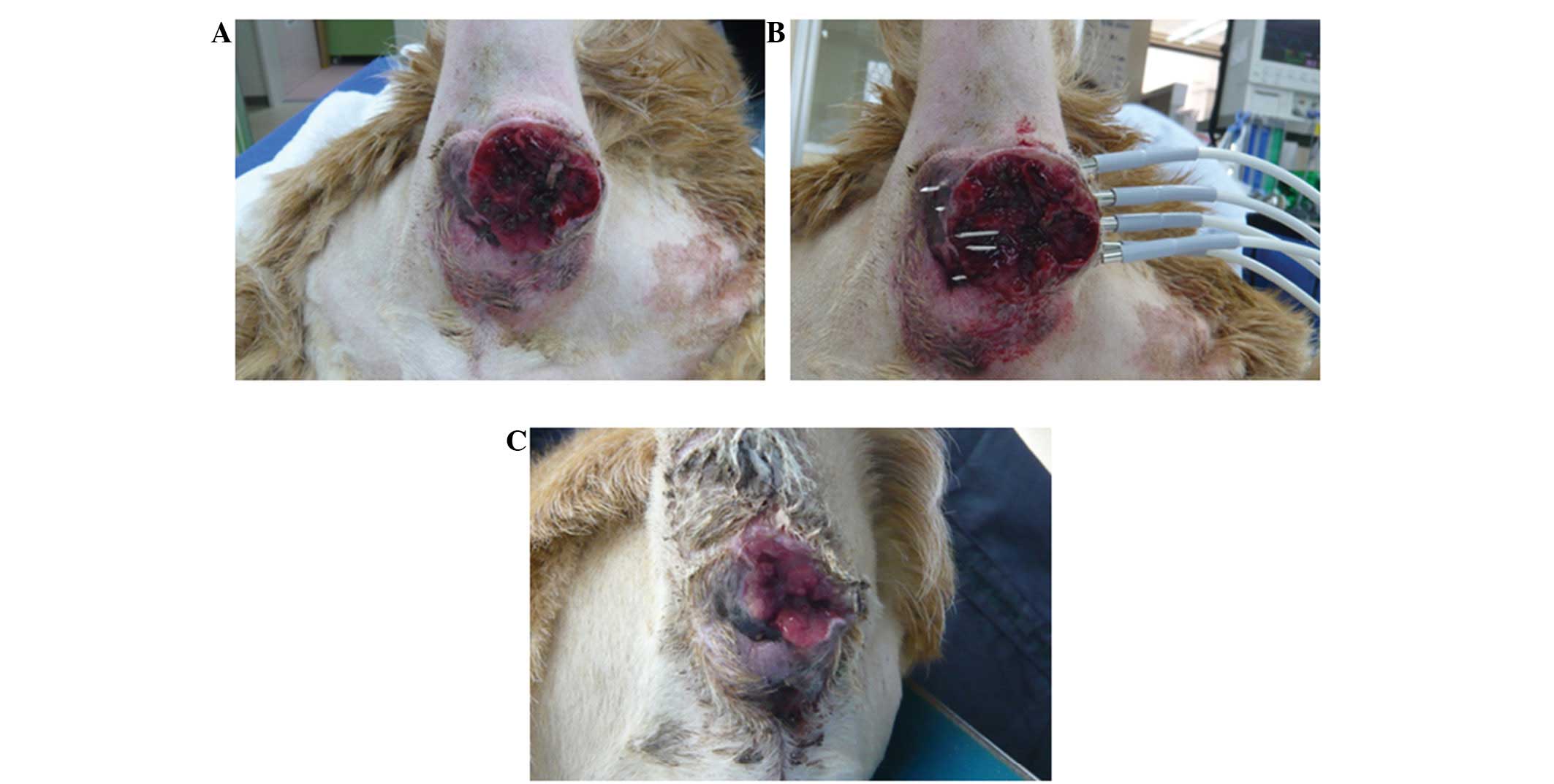 High temperature hyperthermia treatment for canines exhibiting superficial  tumors: A report of three cases