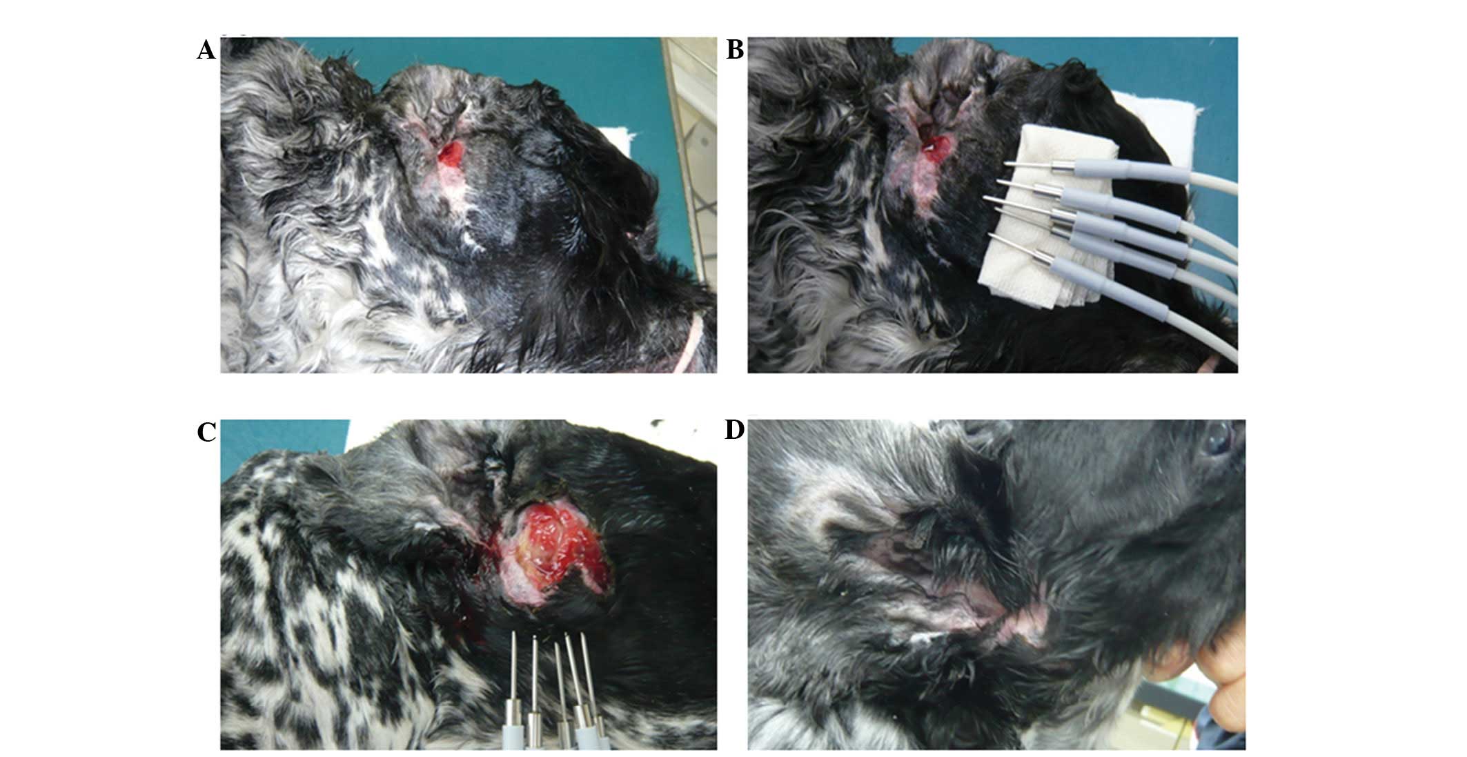 High temperature hyperthermia treatment for canines exhibiting superficial  tumors: A report of three cases