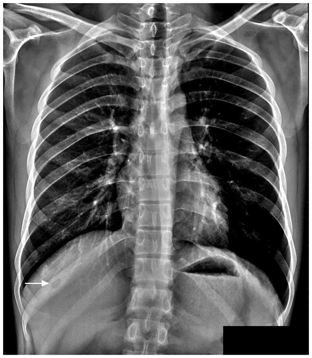 Anatomy Under The Right Rib Here S What It Means If You Have Pain