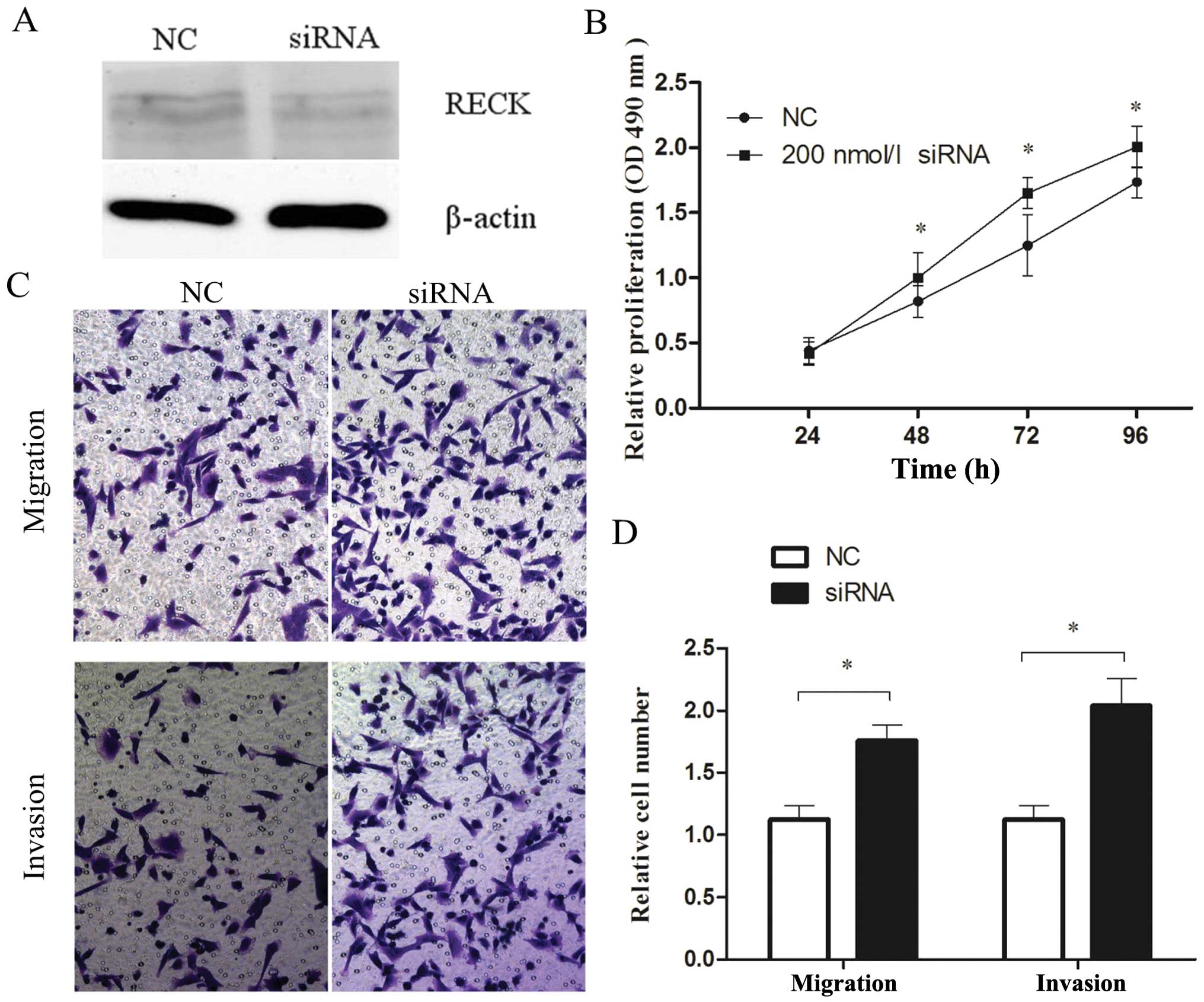 Mir 96 Promotes Tumor Proliferation And Invasion By Targeting Reck In