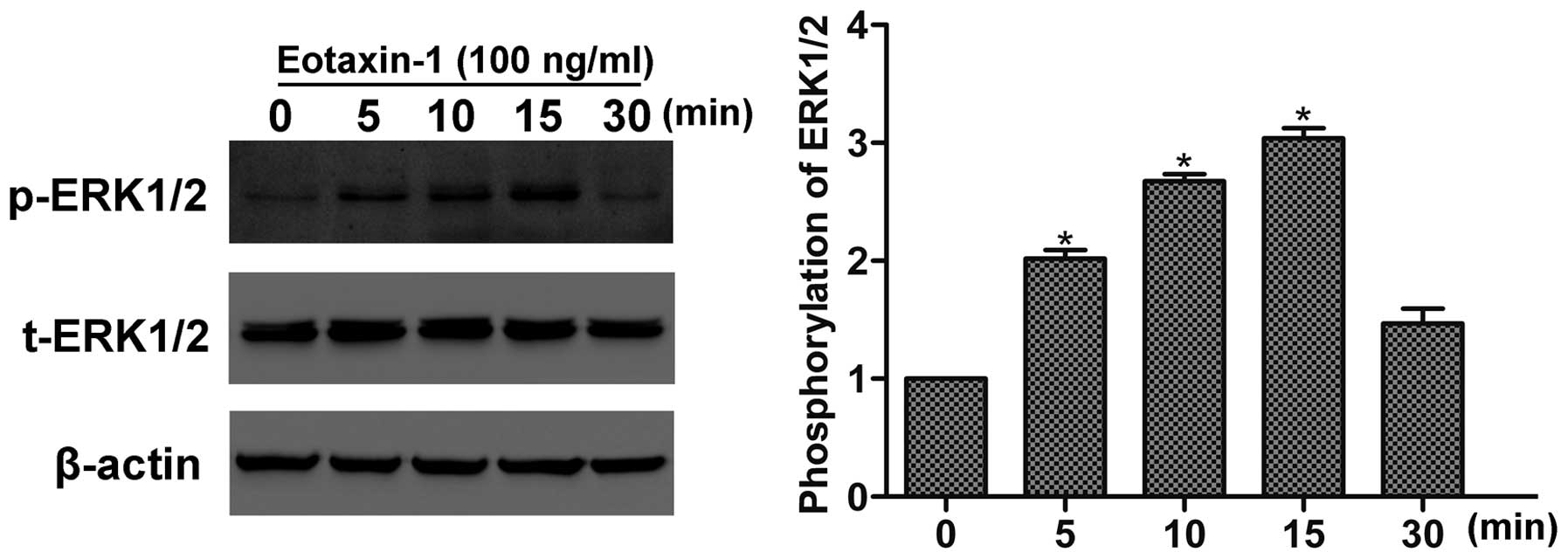 Regulation of MMP-3 expression and secretion by the chemokine eotaxin-1 in  human chondrocytes, Journal of Biomedical Science