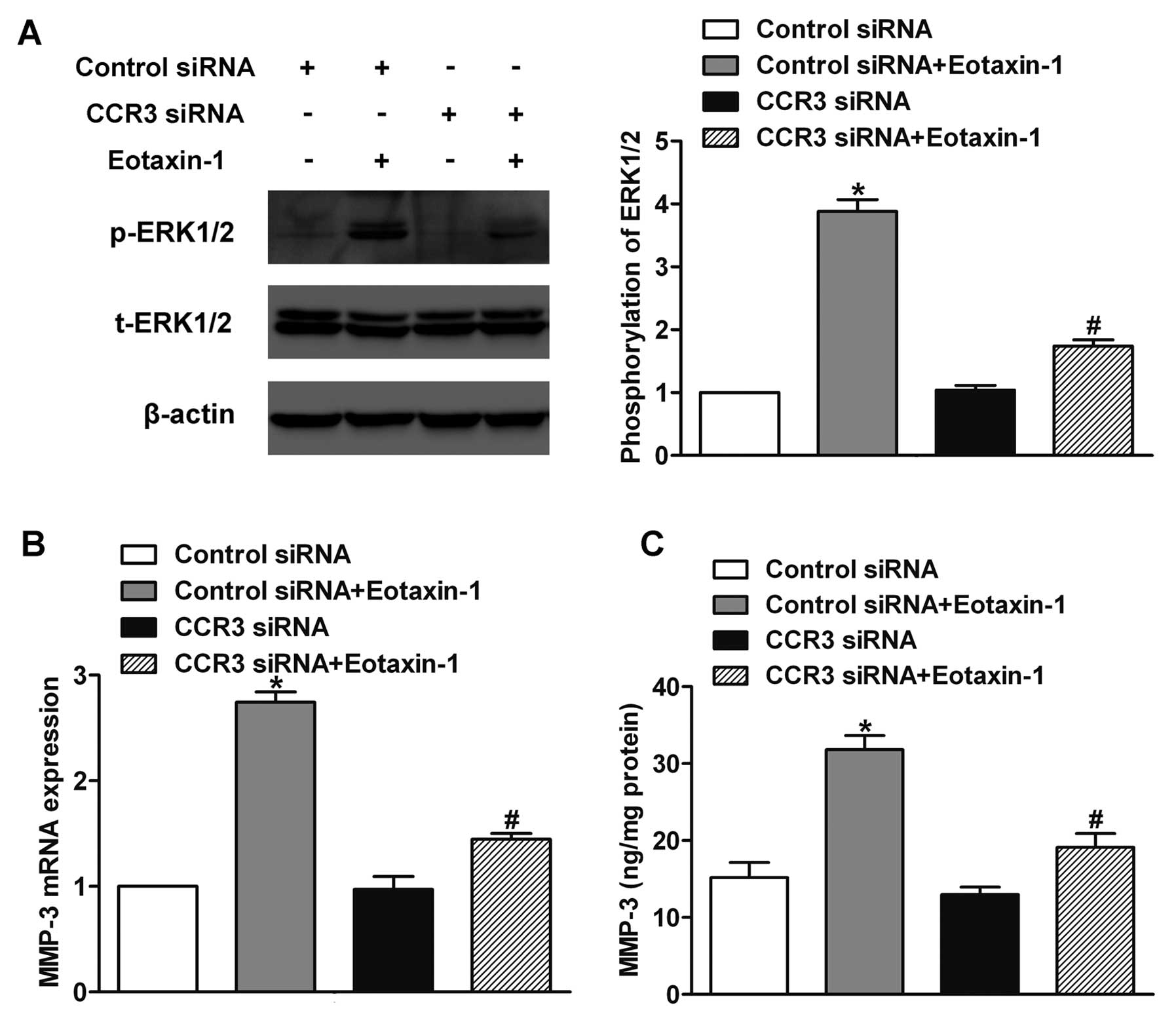 Regulation of MMP-3 expression and secretion by the chemokine eotaxin-1 in  human chondrocytes, Journal of Biomedical Science
