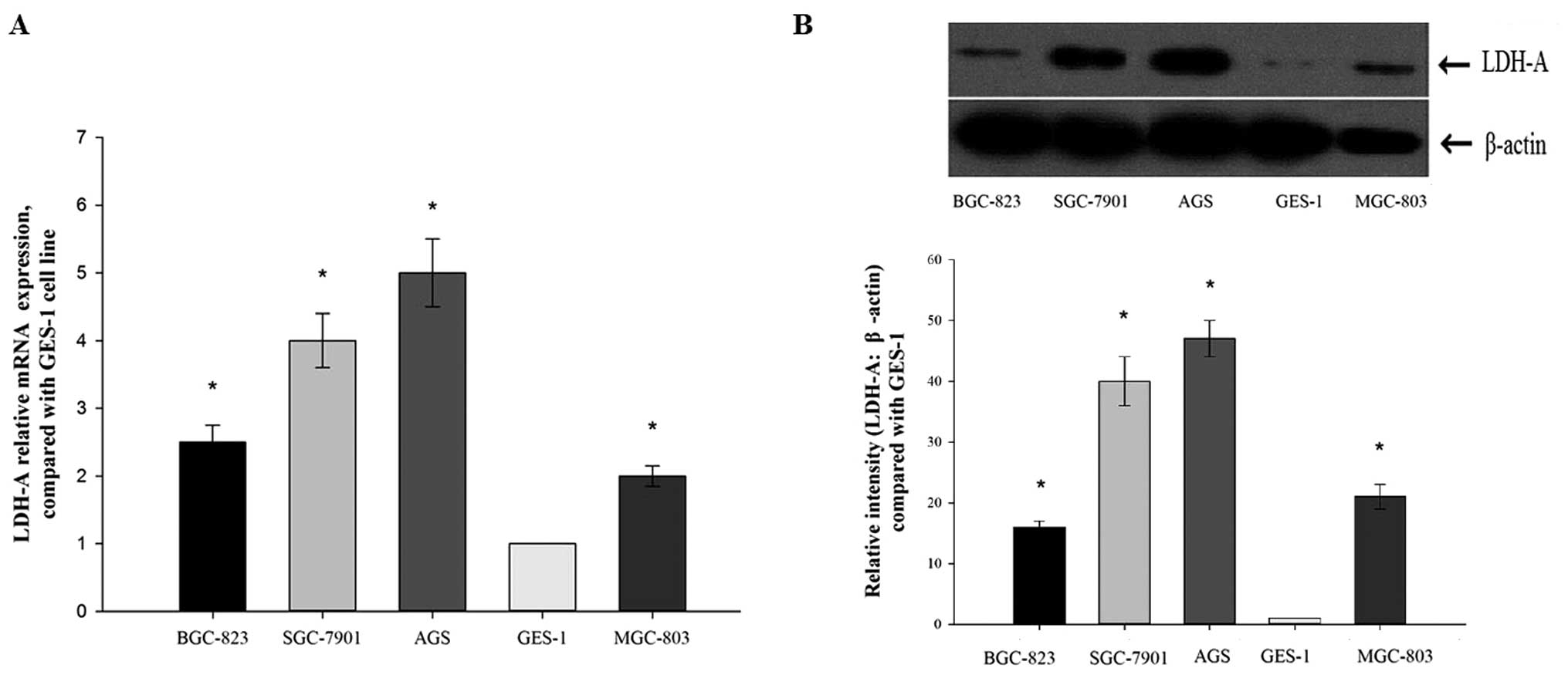 Effects of the suppression of lactate dehydrogenase A on the growth and invasion of human gastric cancer cells
