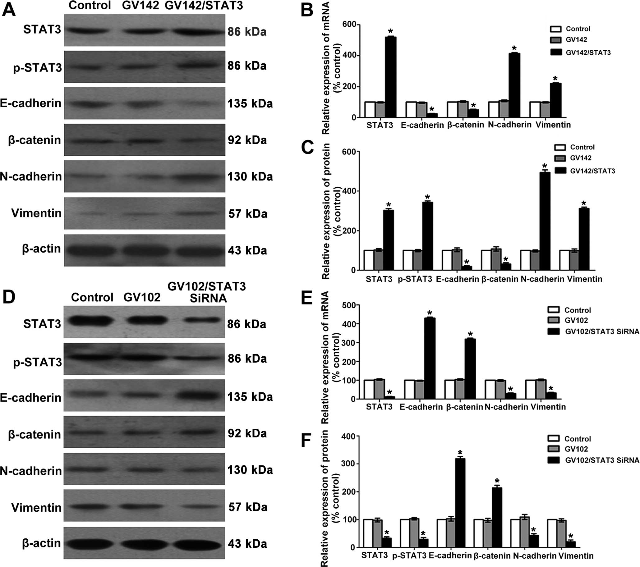 Stat3 Cooperates With Twist To Mediate Epithelial Mesenchymal Transition In Human Hepatocellular Carcinoma Cells