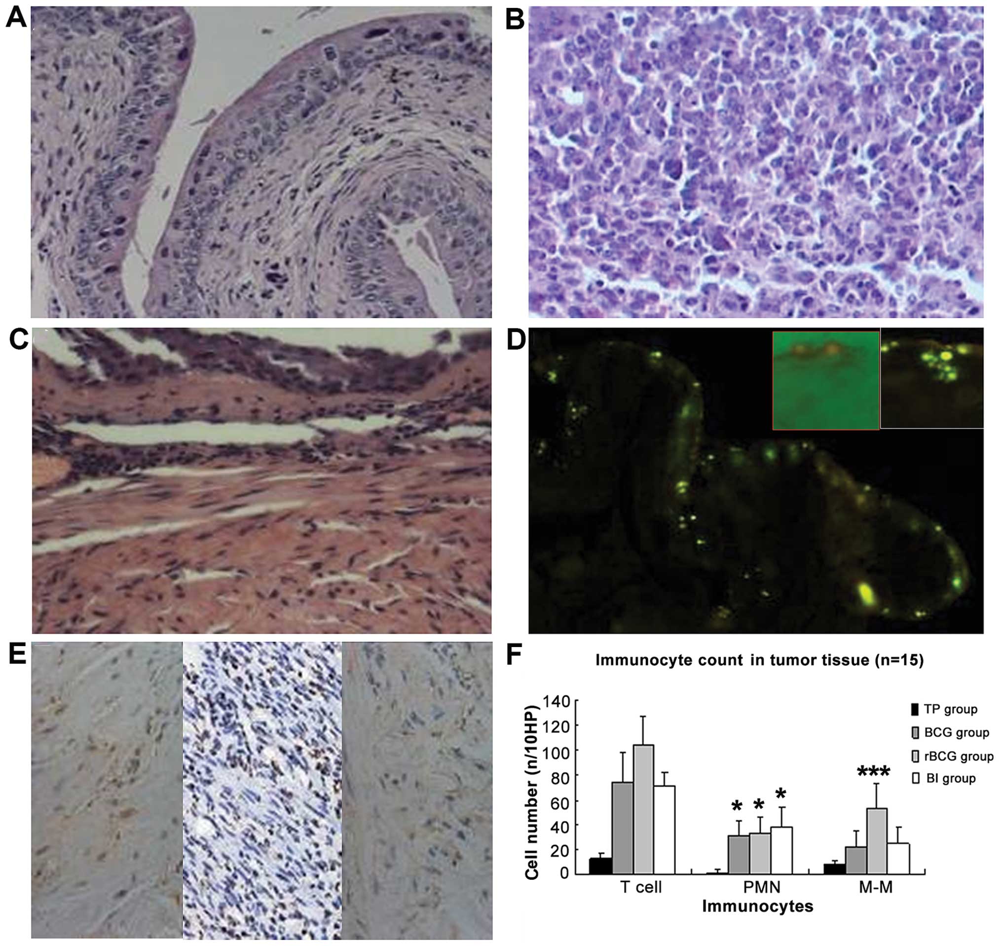 Recombinant Hifn b g Inhibits Tumor Growth In A Mouse Model Of Bladder Cancer