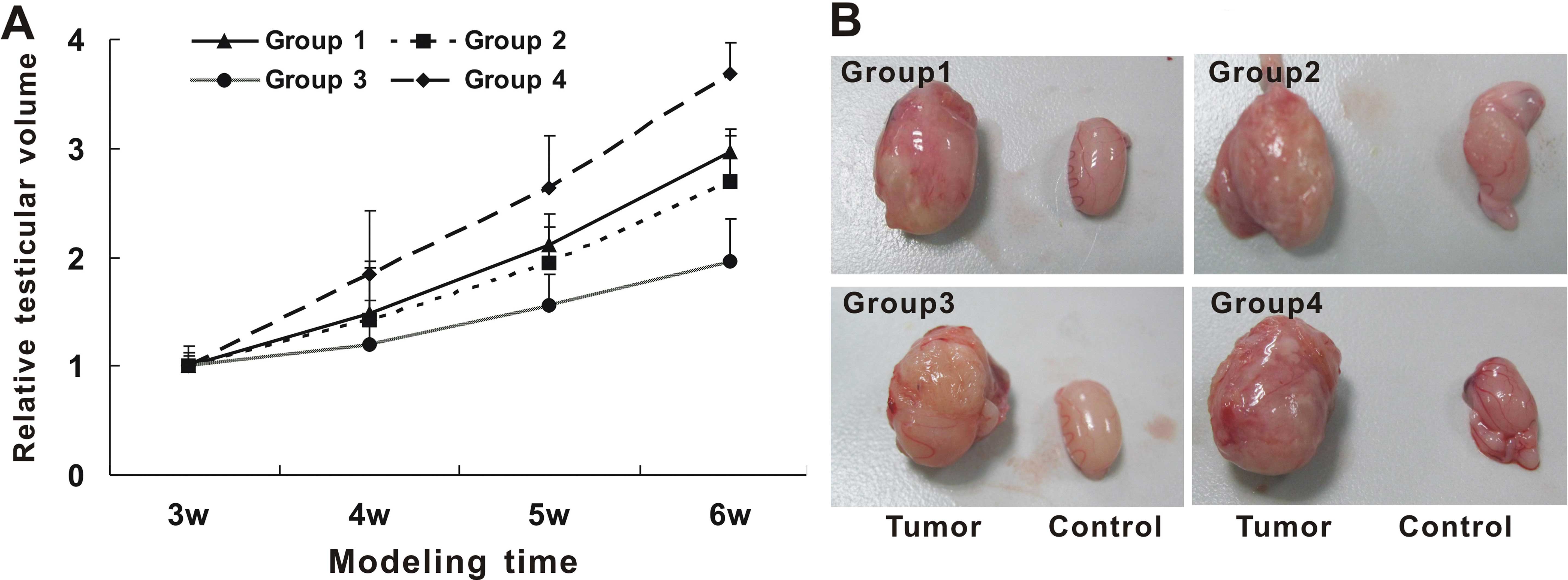 Testis apa kanser Testicular Cancer