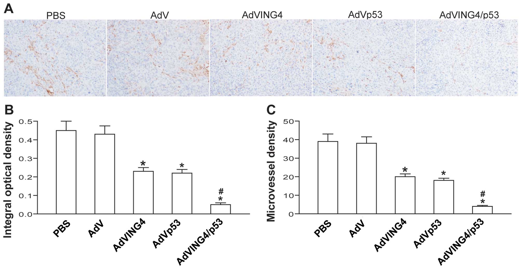 Adenovirus-mediated p53 and ING4 gene co‑transfer elicits 