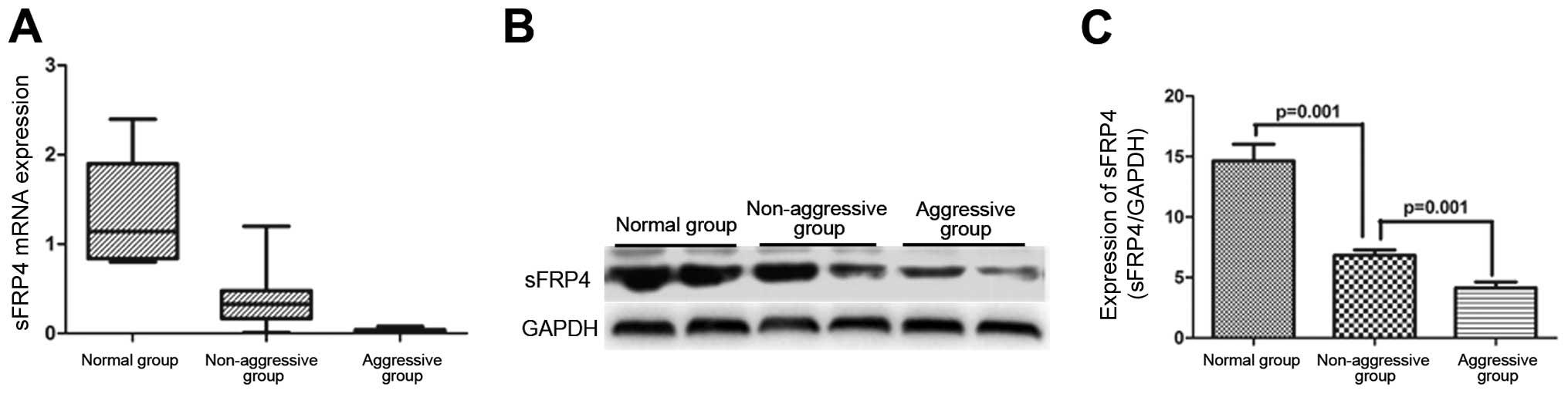 2010 versus the 2000 consensus criteria in patients with normalised  insulin‐like growth factor 1 after transsphenoidal surgery has high  predictive values for long‐term recurrence‐free survival in acromegaly -  Shen - 2021 