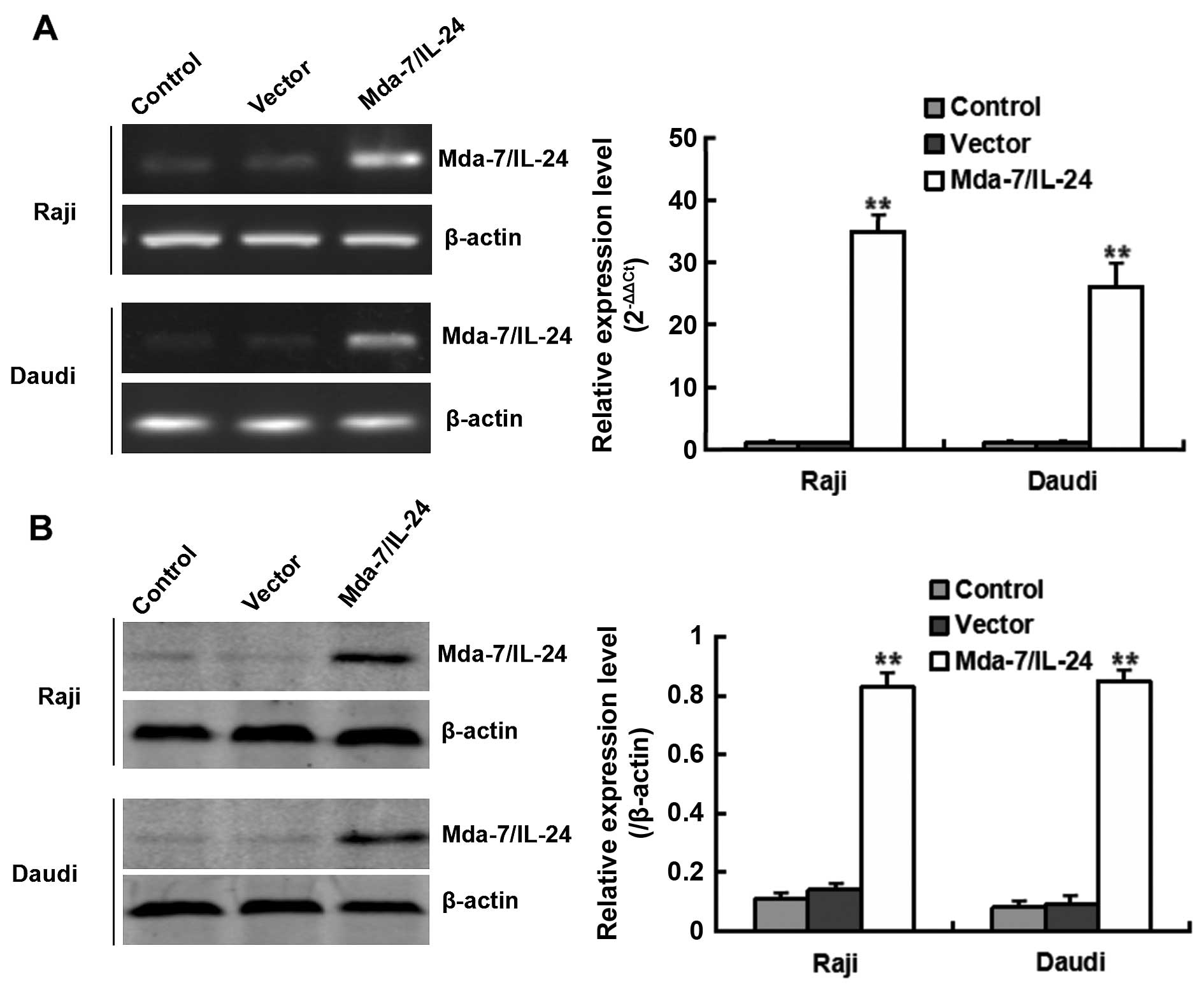 Mda-7/IL-24 enhances sensitivity of B cell lymphoma to 