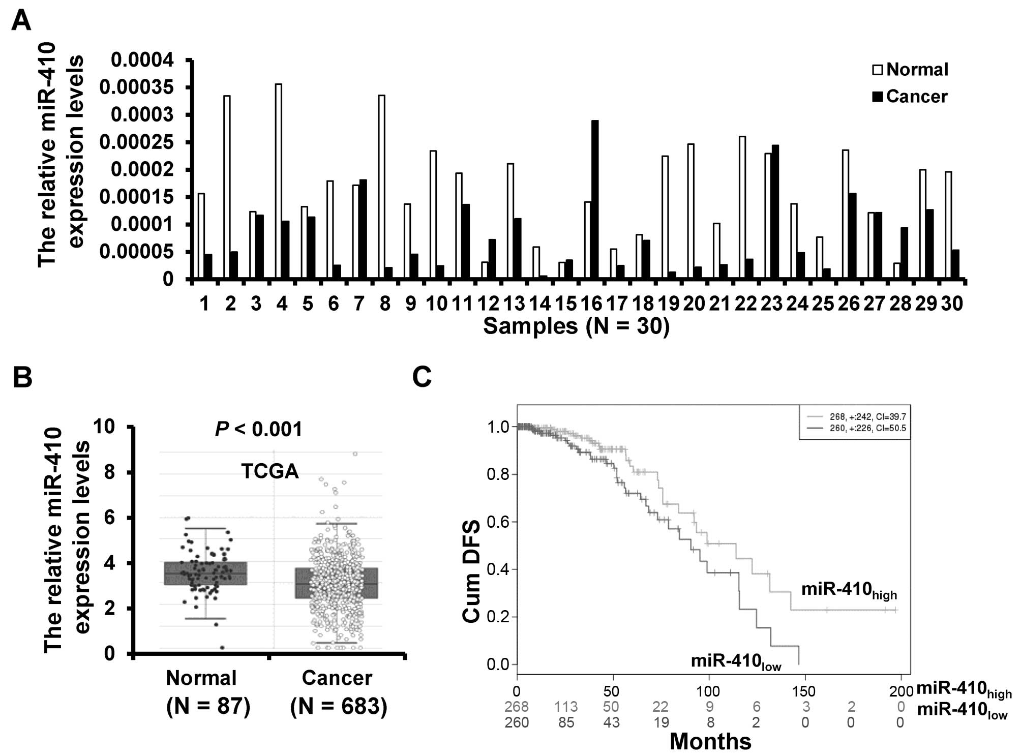 miR-410-3p suppresses breast cancer progression by targeting Snail