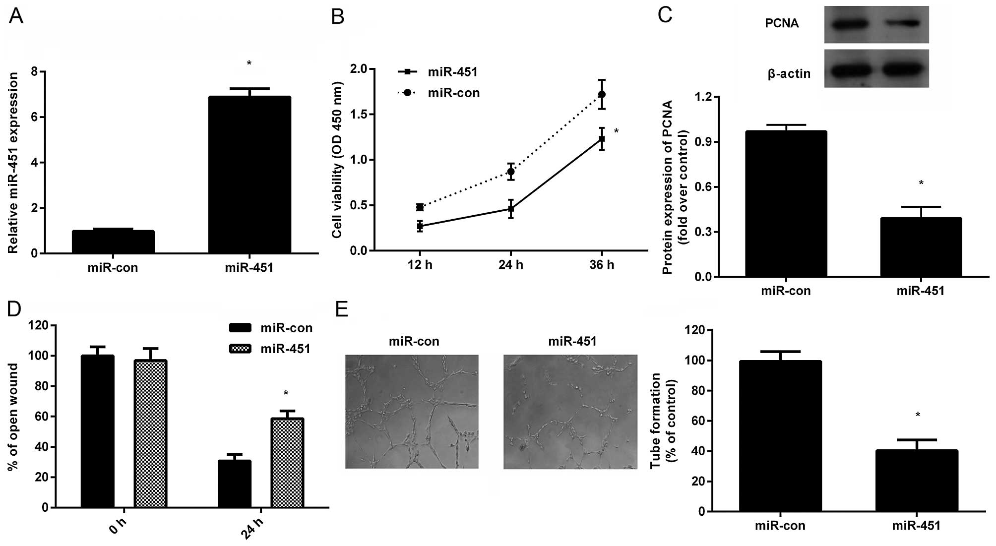 Mir 451 Acts As A Suppressor Of Angiogenesis In Hepatocellular Carcinoma By Targeting The Il 6r