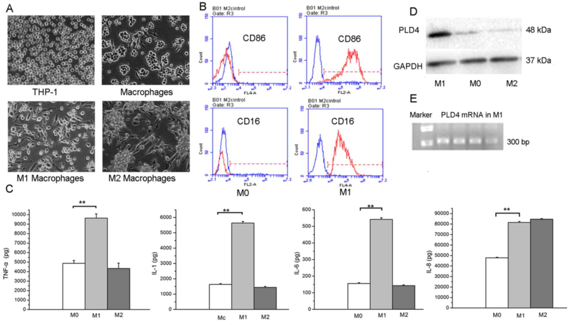 PLD4 promotes M1 to perform antitumor effects in colon cancer cells