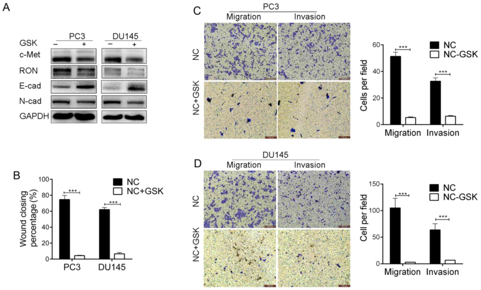 Ron And C Met Facilitate Metastasis Through The Erk Signaling Pathway In Prostate Cancer Cells