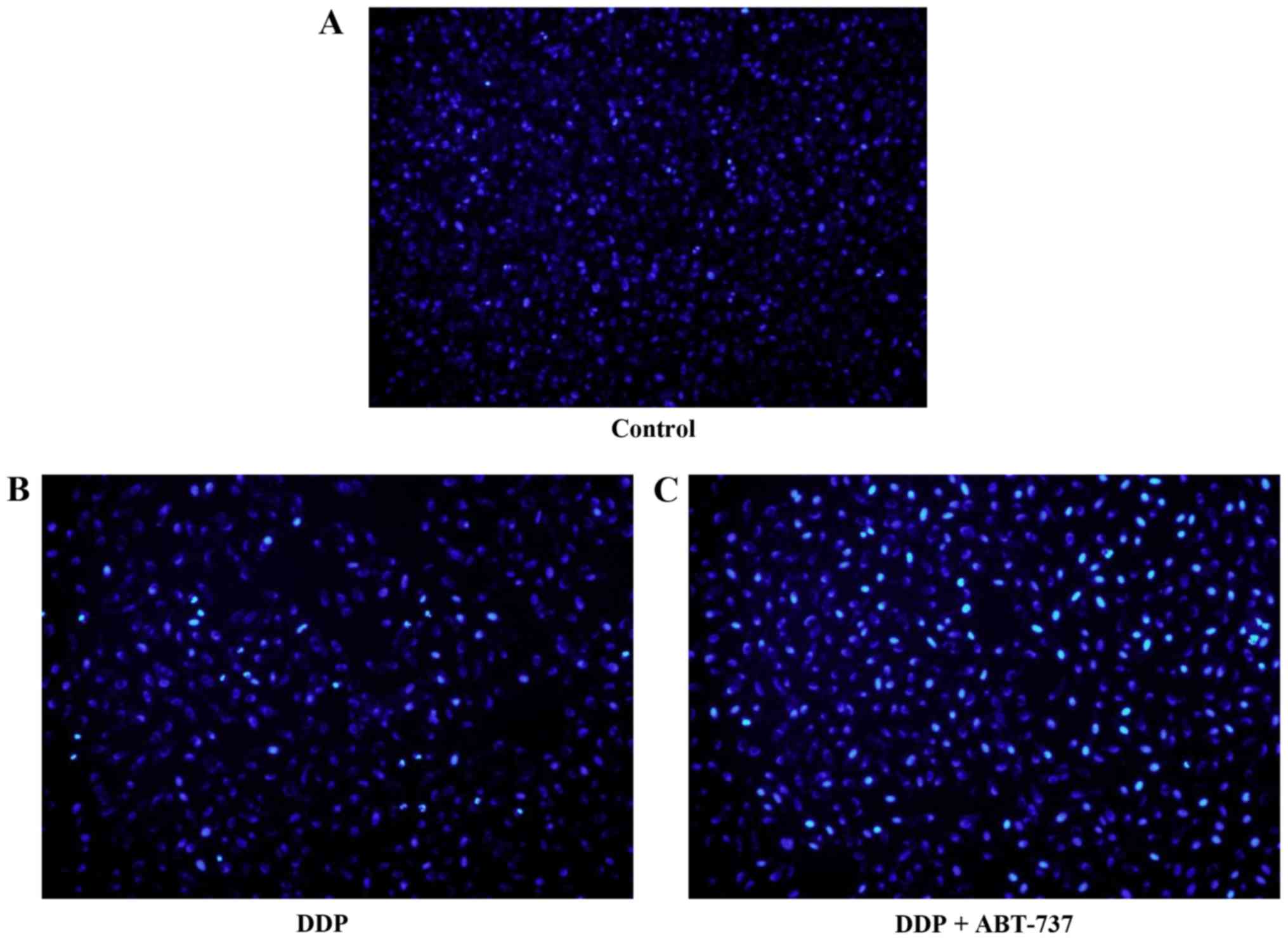 ABT-737 potentiates cisplatin-induced apoptosis in human 