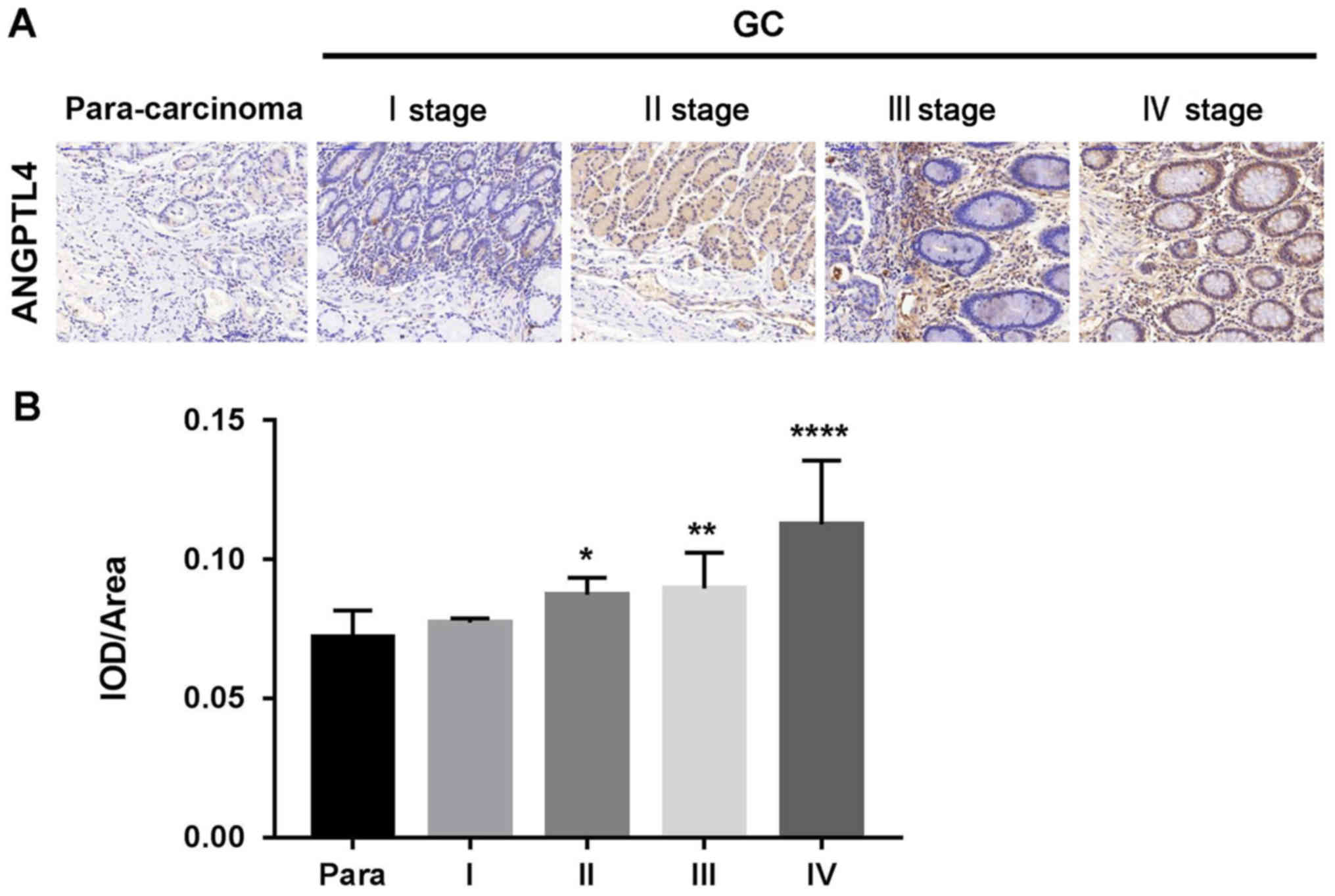 Angiopoietin‑like 4 promotes melanoma cell invasion and 