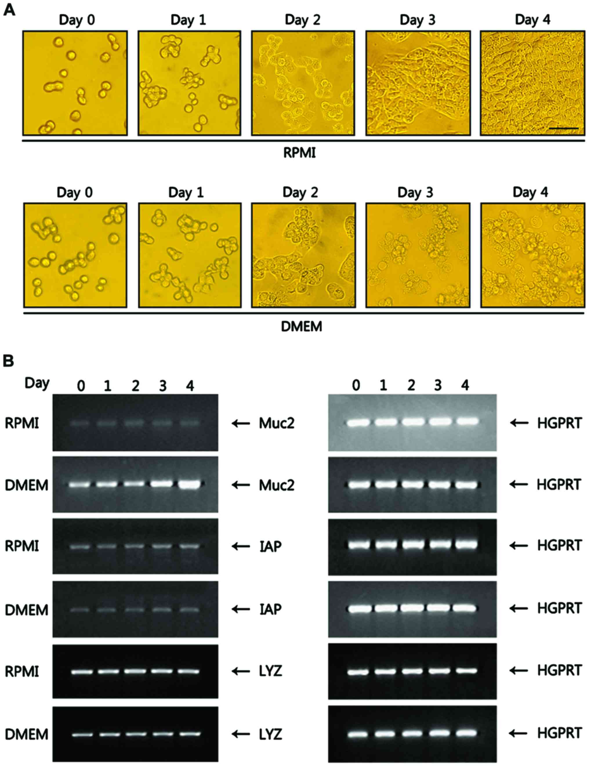 Kynurenine Promotes The Goblet Cell Differentiation Of Ht 29 Colon Carcinoma Cells By Modulating Wnt Notch And Ahr Signals