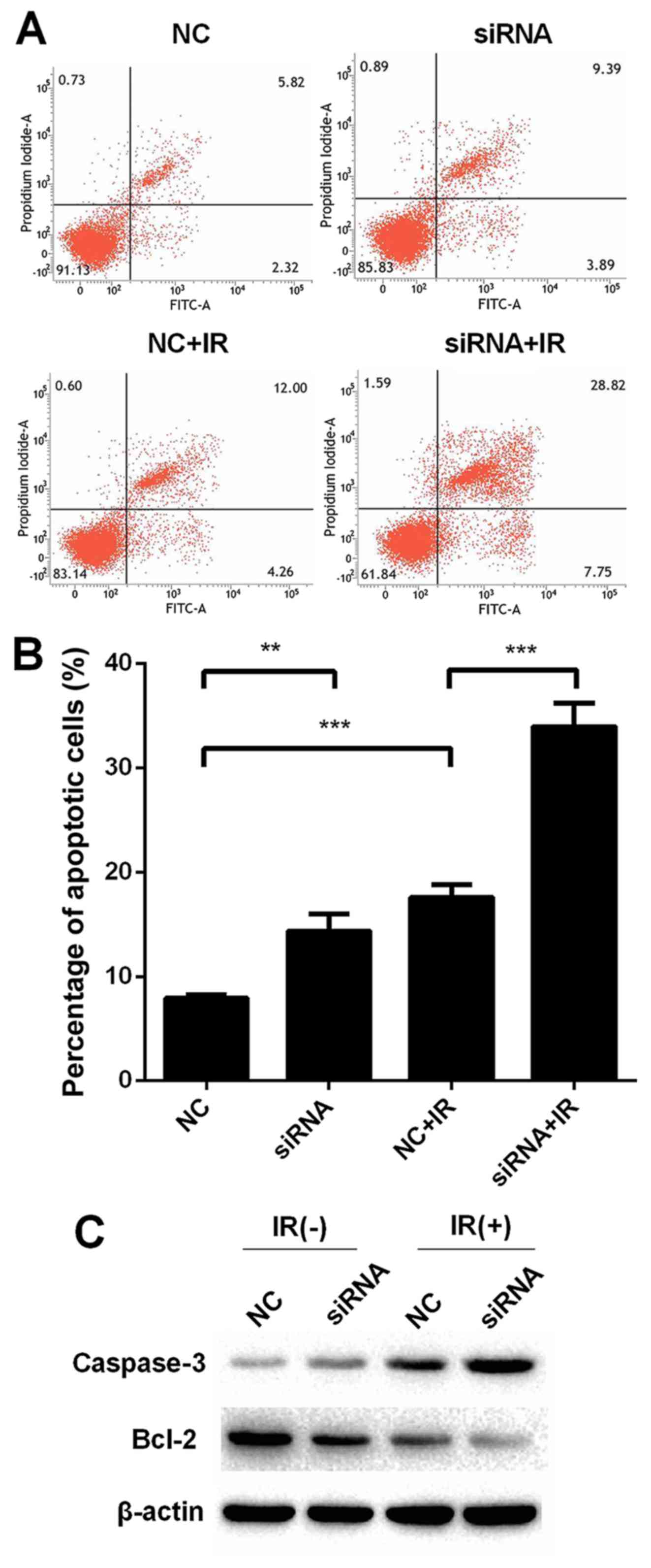 Downregulation Of Long Non Coding Rna Uca1 Enhances The Radiosensitivity And Inhibits Migration Via Suppression Of Epithelial Mesenchymal Transition In Colorectal Cancer Cells