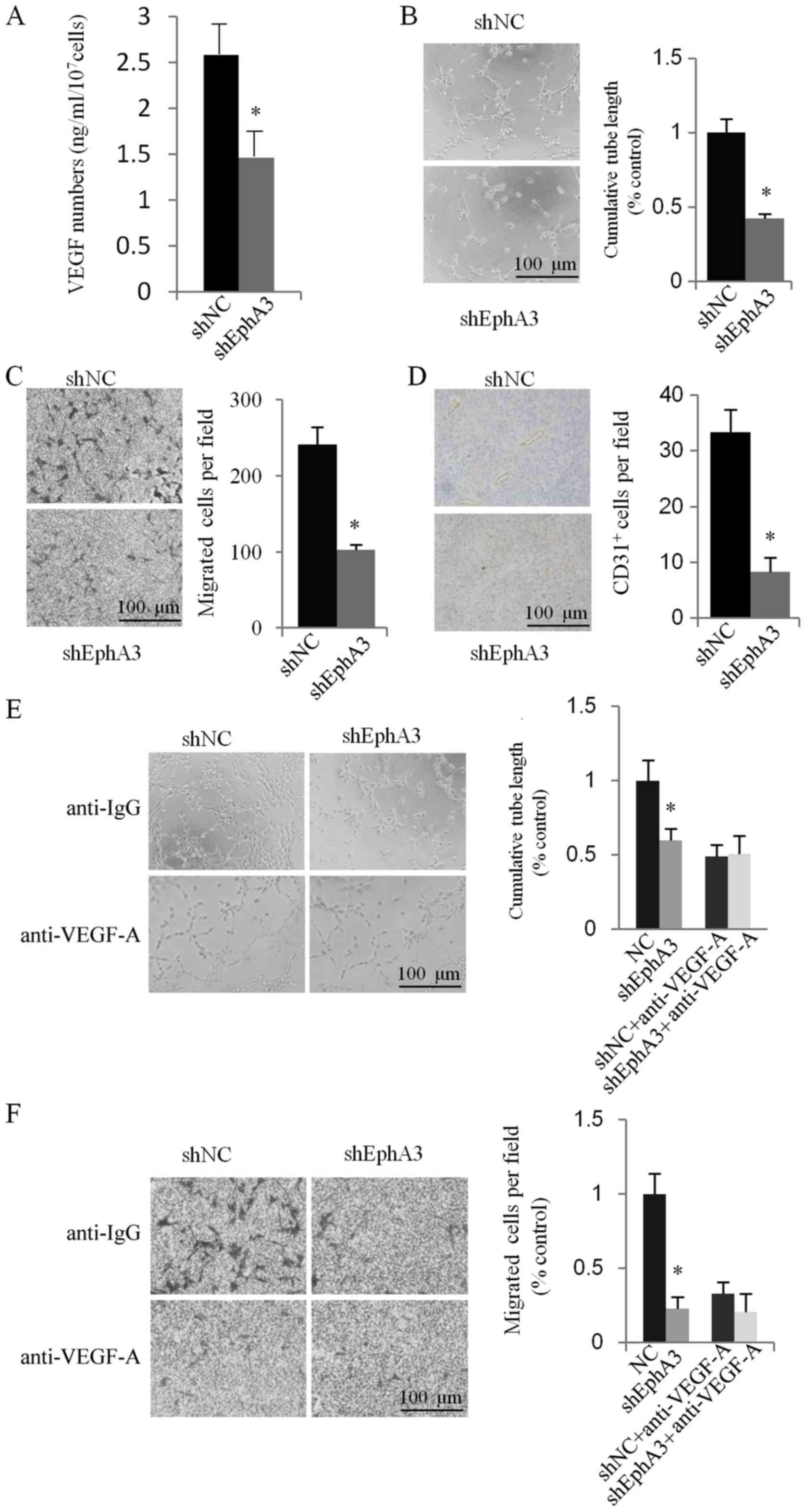 EphA3 contributes to tumor growth and angiogenesis in human 