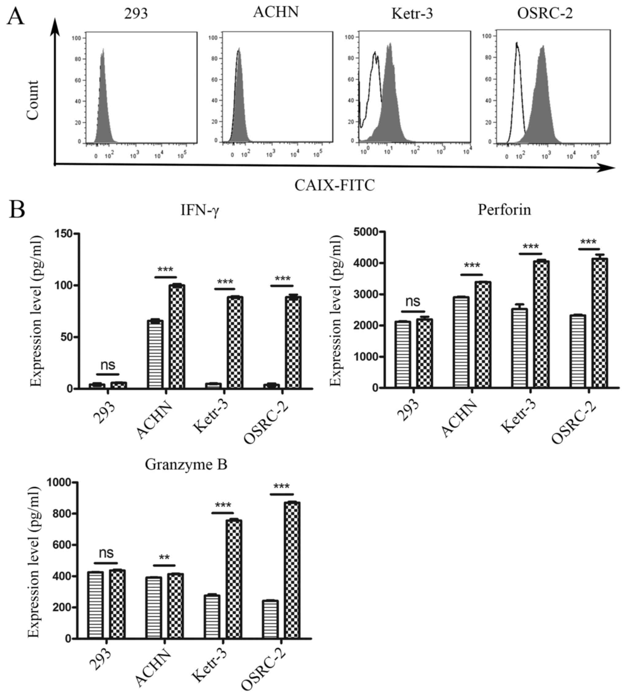 CD16+NK-92 and anti-CD123 monoclonal antibody prolongs survival in ...