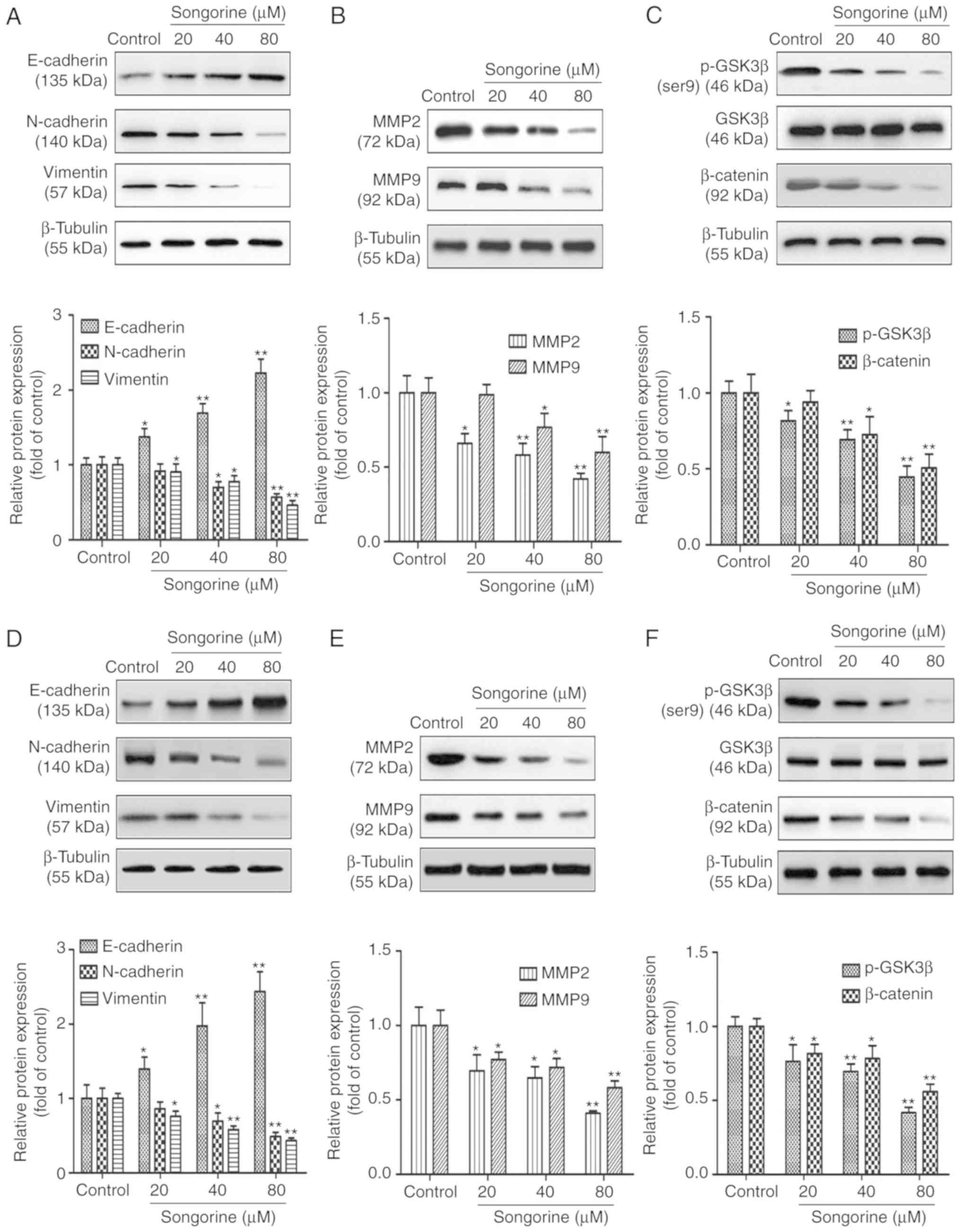 Songorine suppresses cell growth and metastasis in epithelial ovarian ...