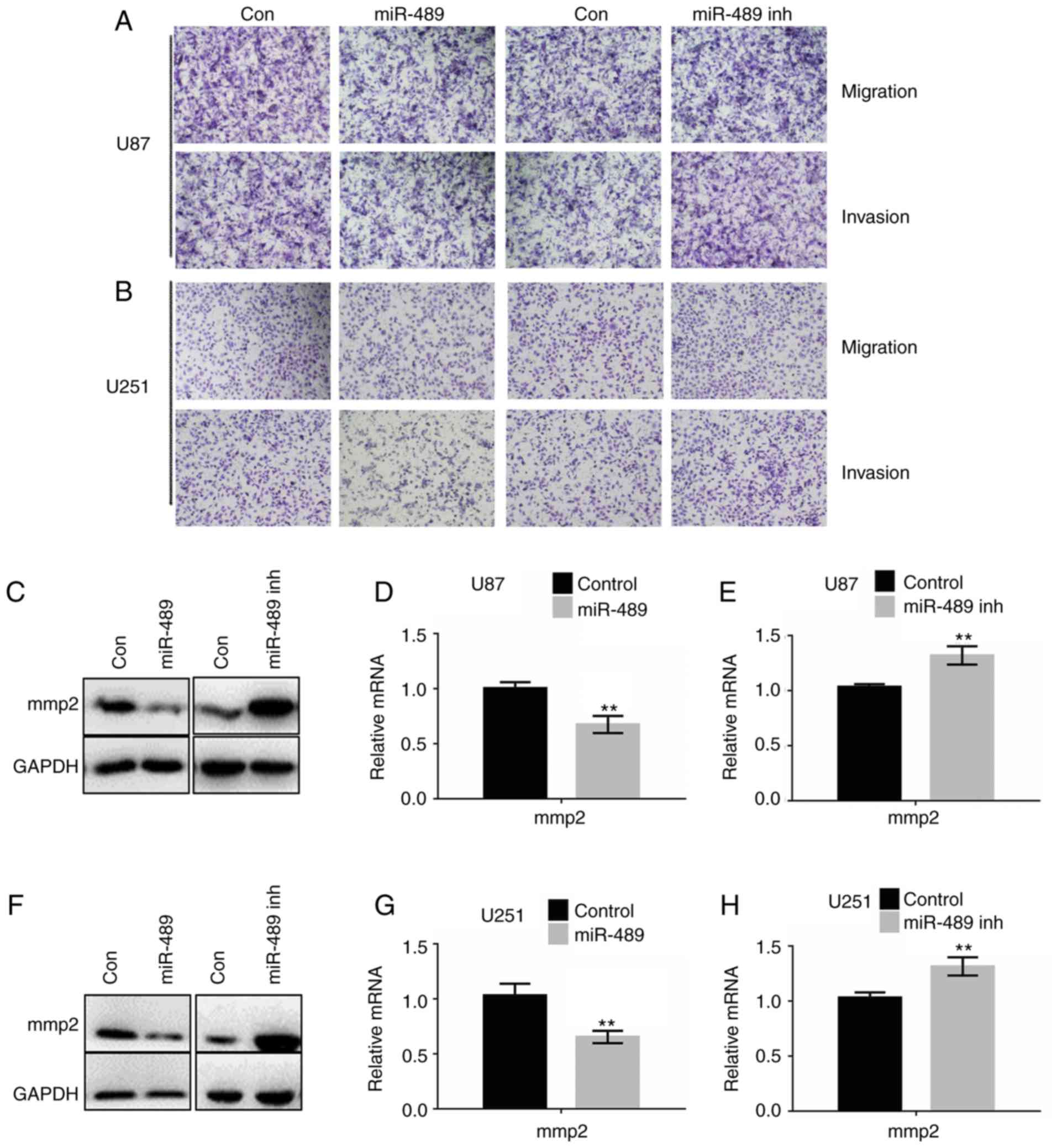 miR‑489 promotes apoptosis and inhibits invasiveness of glioma 