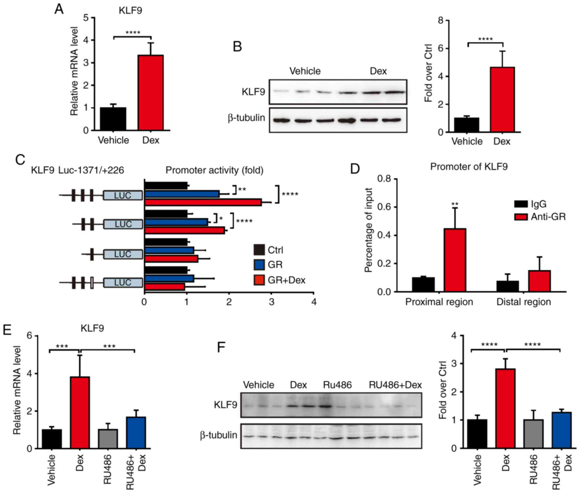 Dexamethasone Induces Aberrant Macrophage Immune Function And Apoptosis