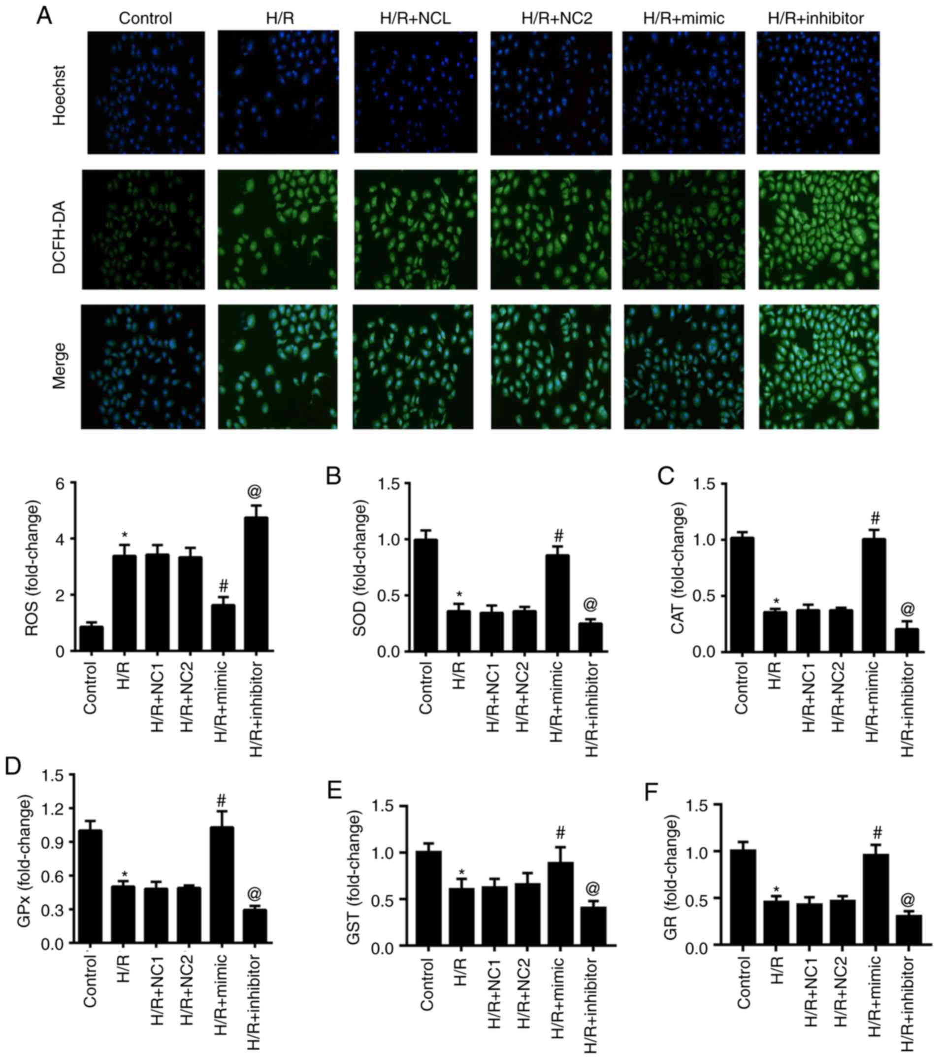 Mir 30a 5p Inhibits Hypoxia Reoxygenation Induced Oxidative Stress And Apoptosis In Hk 2 Renal Tubular Epithelial Cells By Targeting Glutamate Dehydrogenase 1 Glud1
