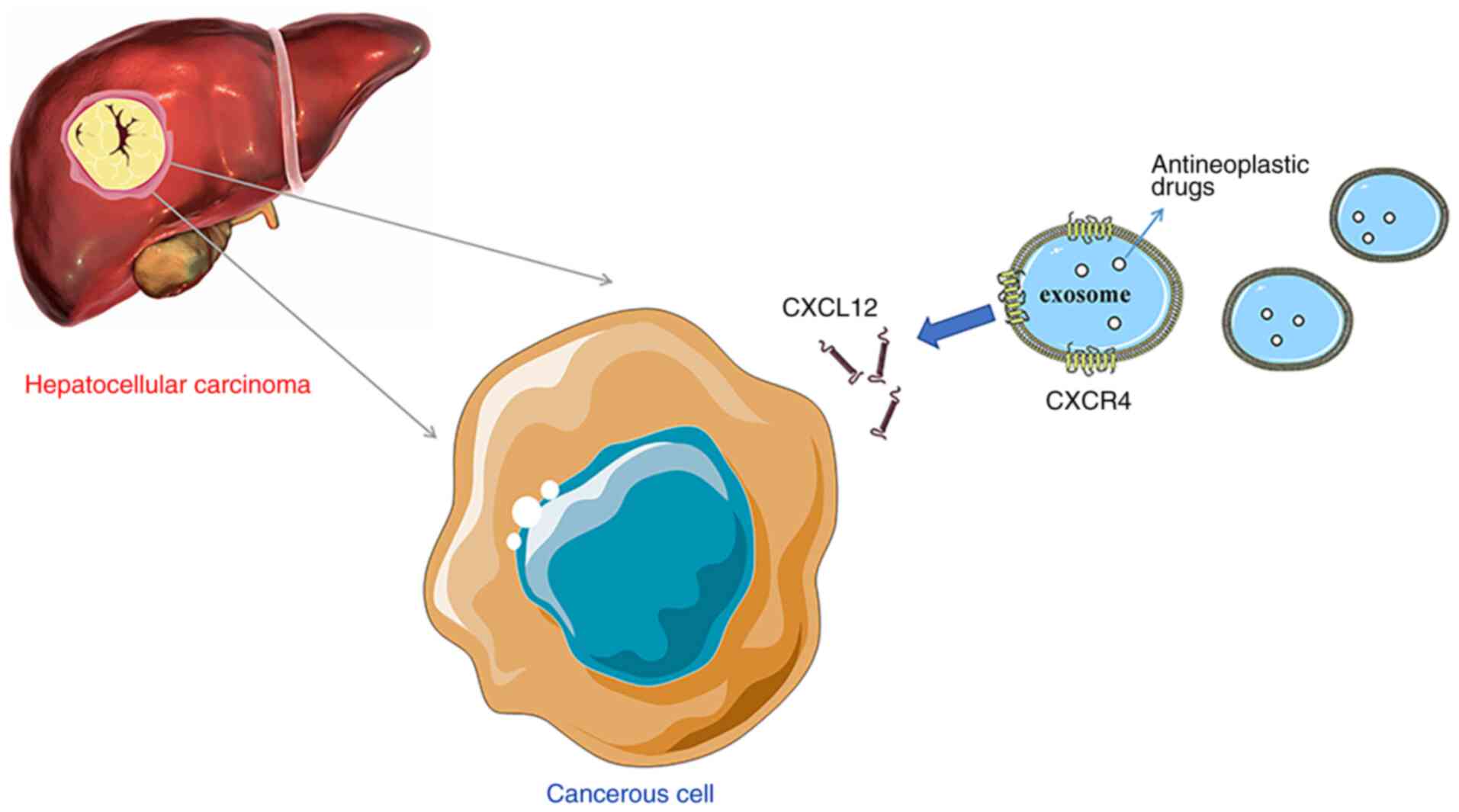 Role of chemokines in hepatocellular carcinoma (Review)