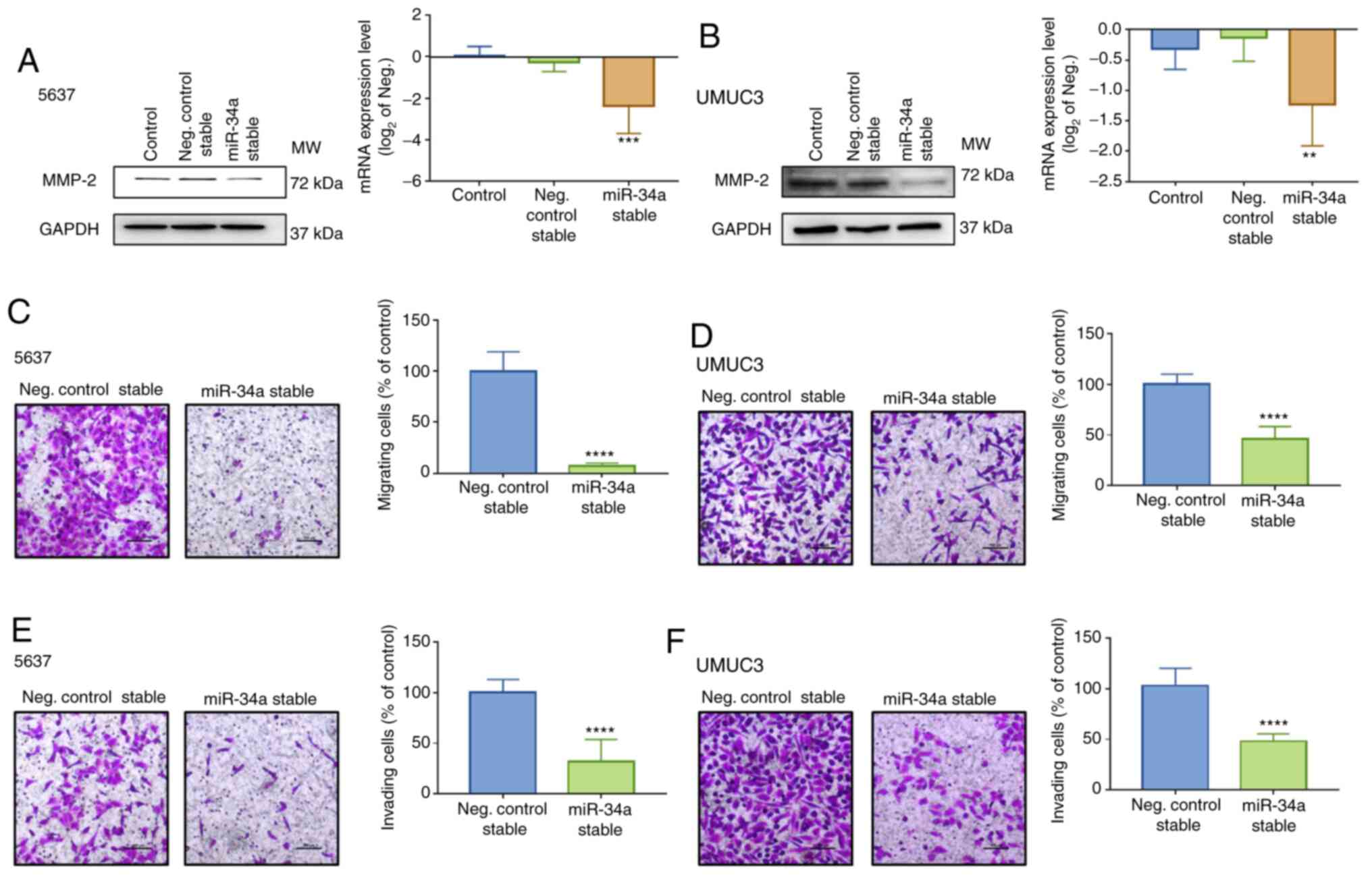 Microrna‑34a‑5p Serves As A Tumor Suppressor By Regulating The Cell Motility Of Bladder Cancer